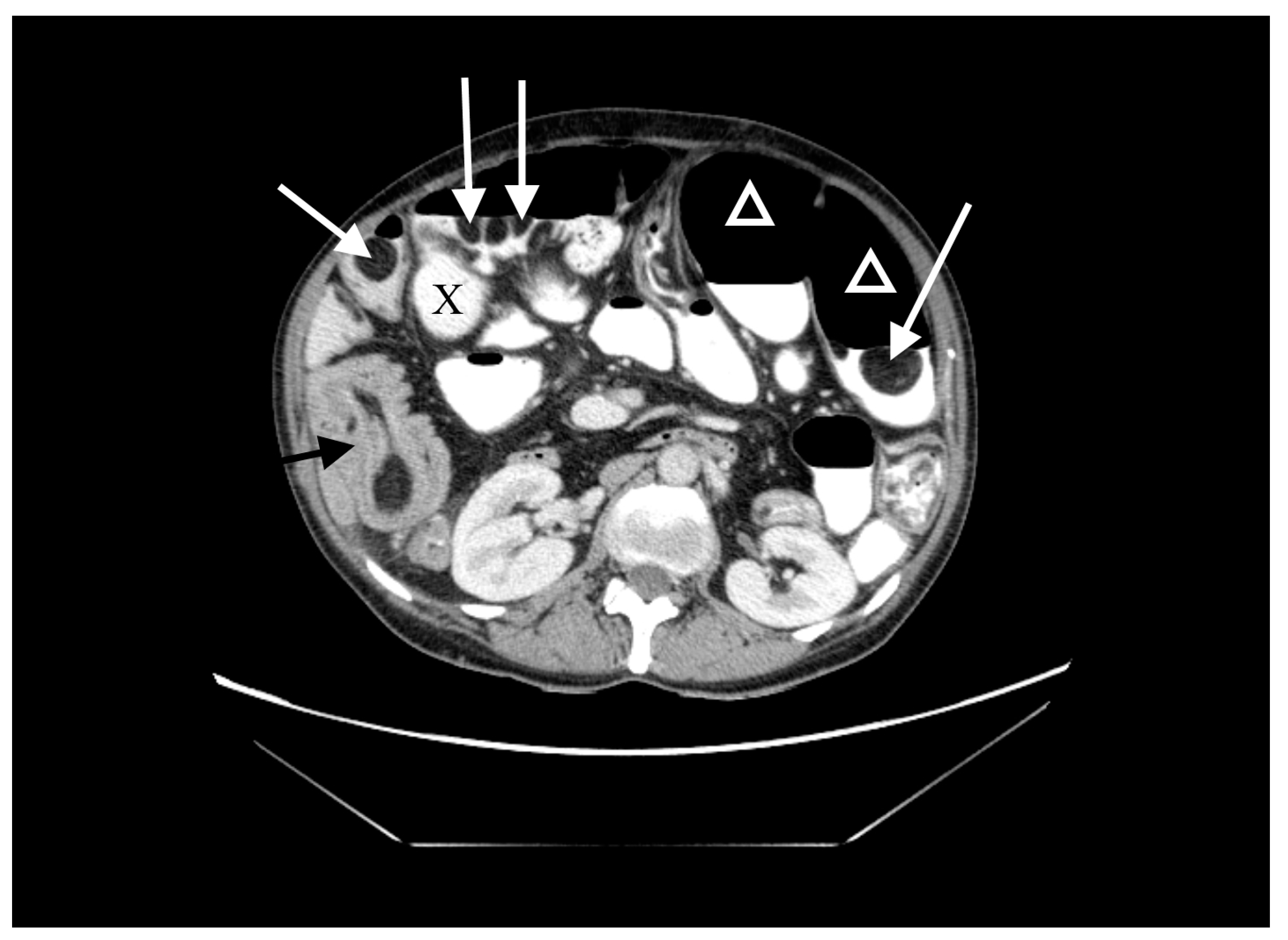 Medicina 57 00116 g001