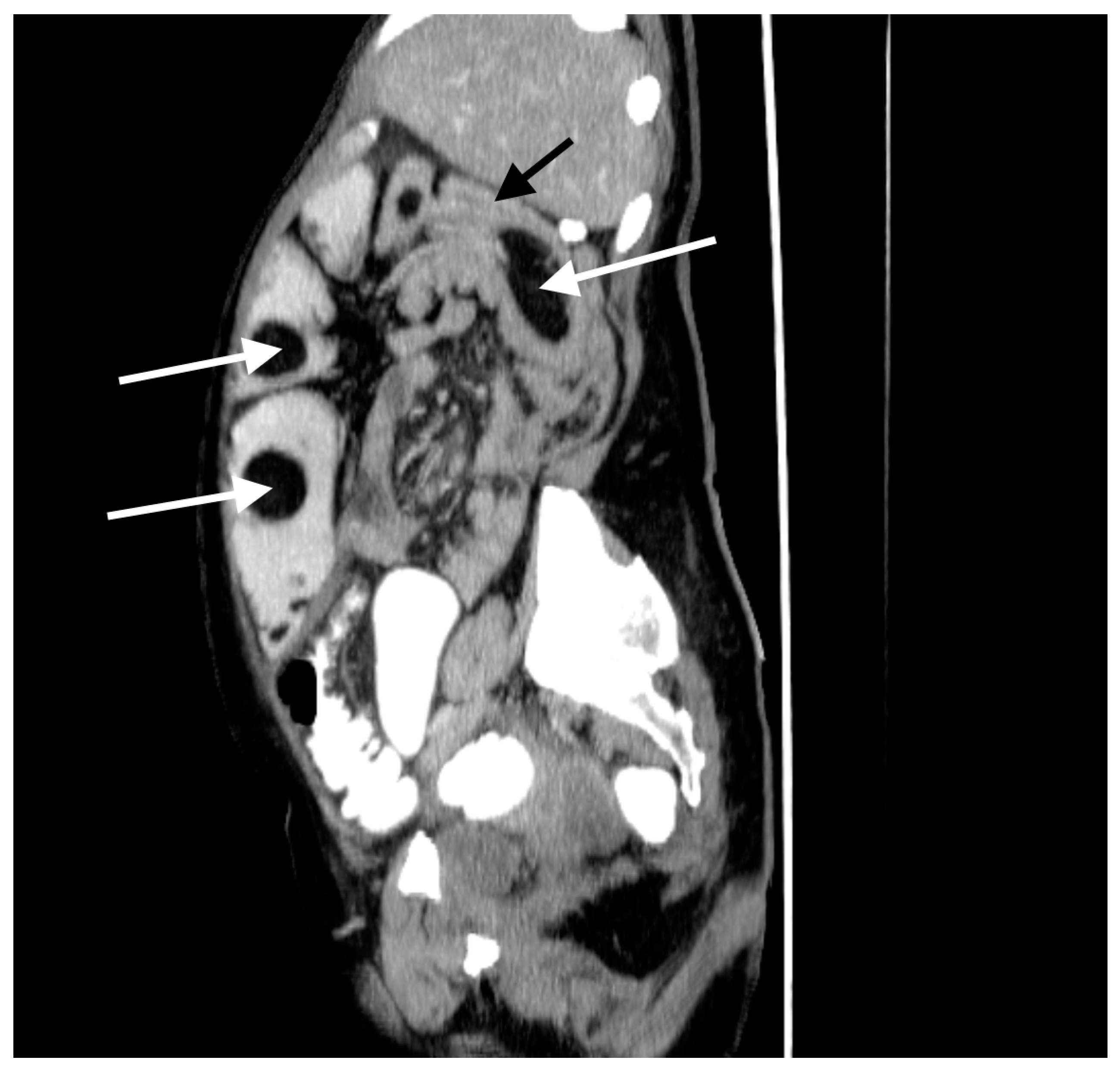 Medicina 57 00116 g002