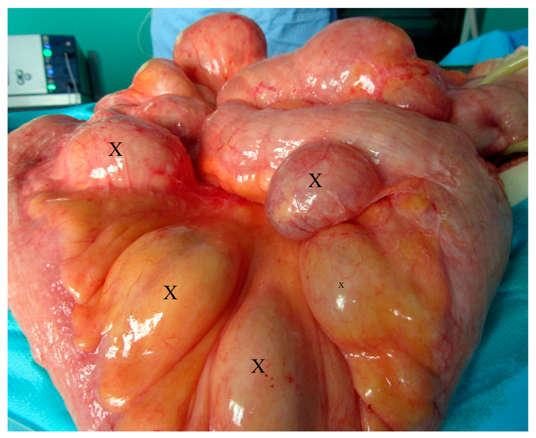 Medicina 57 00116 g004