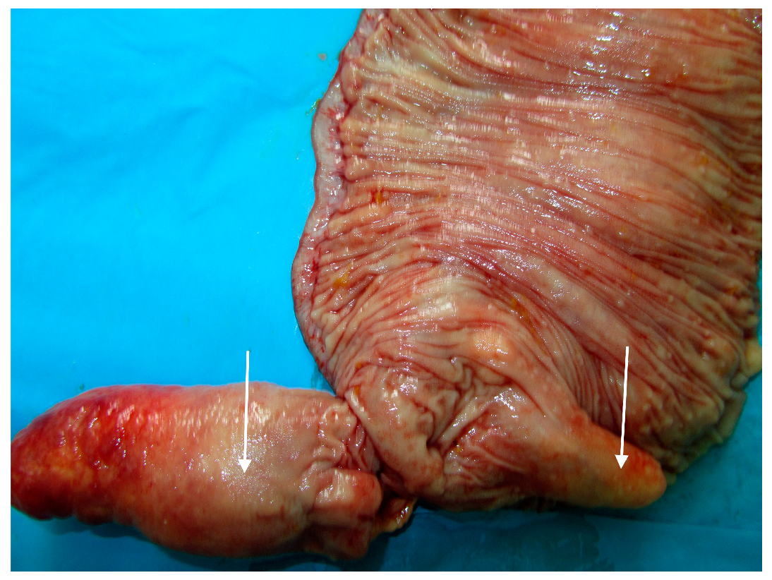 Medicina 57 00116 g005