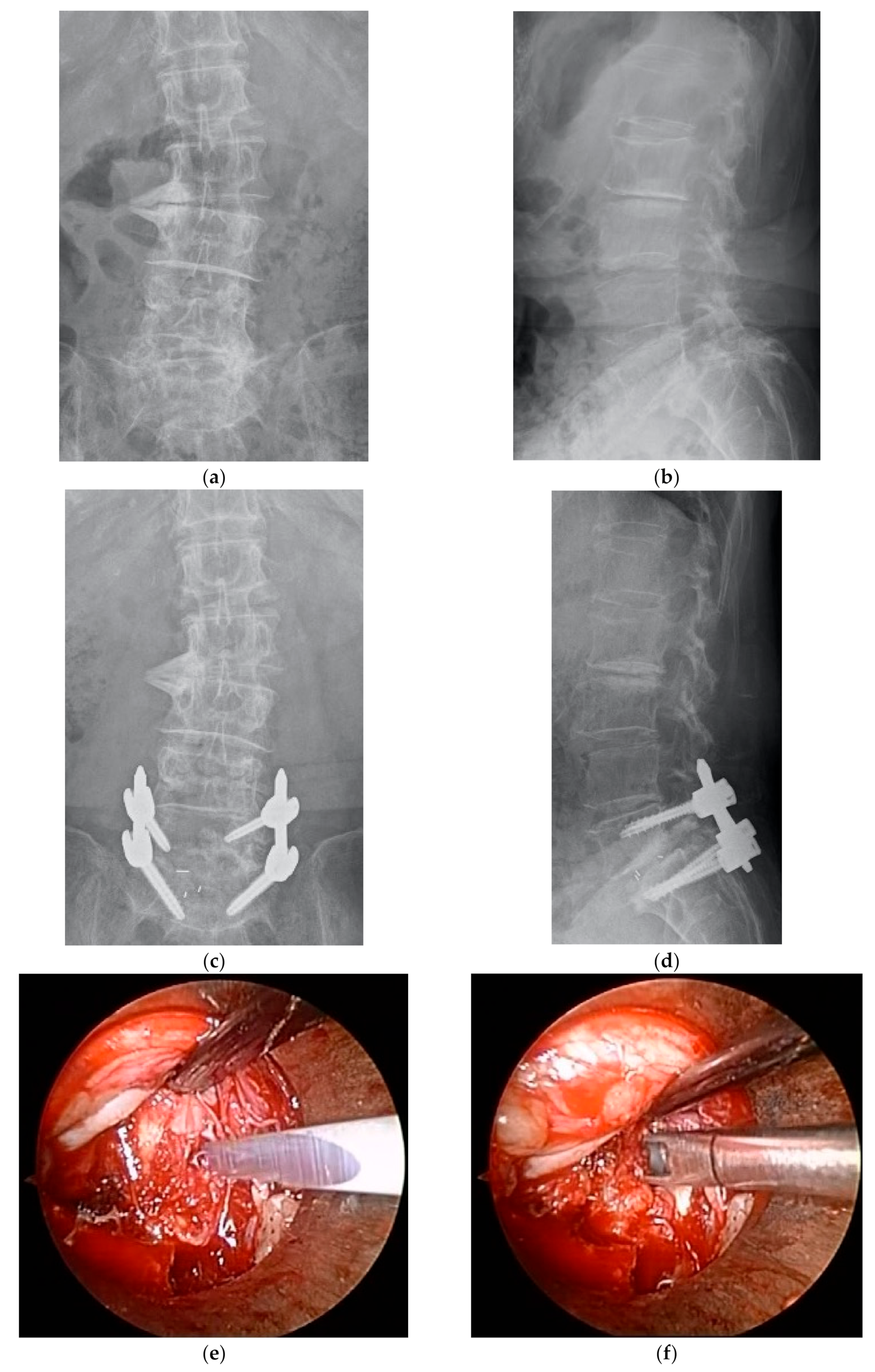 Medicina 57 00150 g001a Medicina 57 00150 g001a