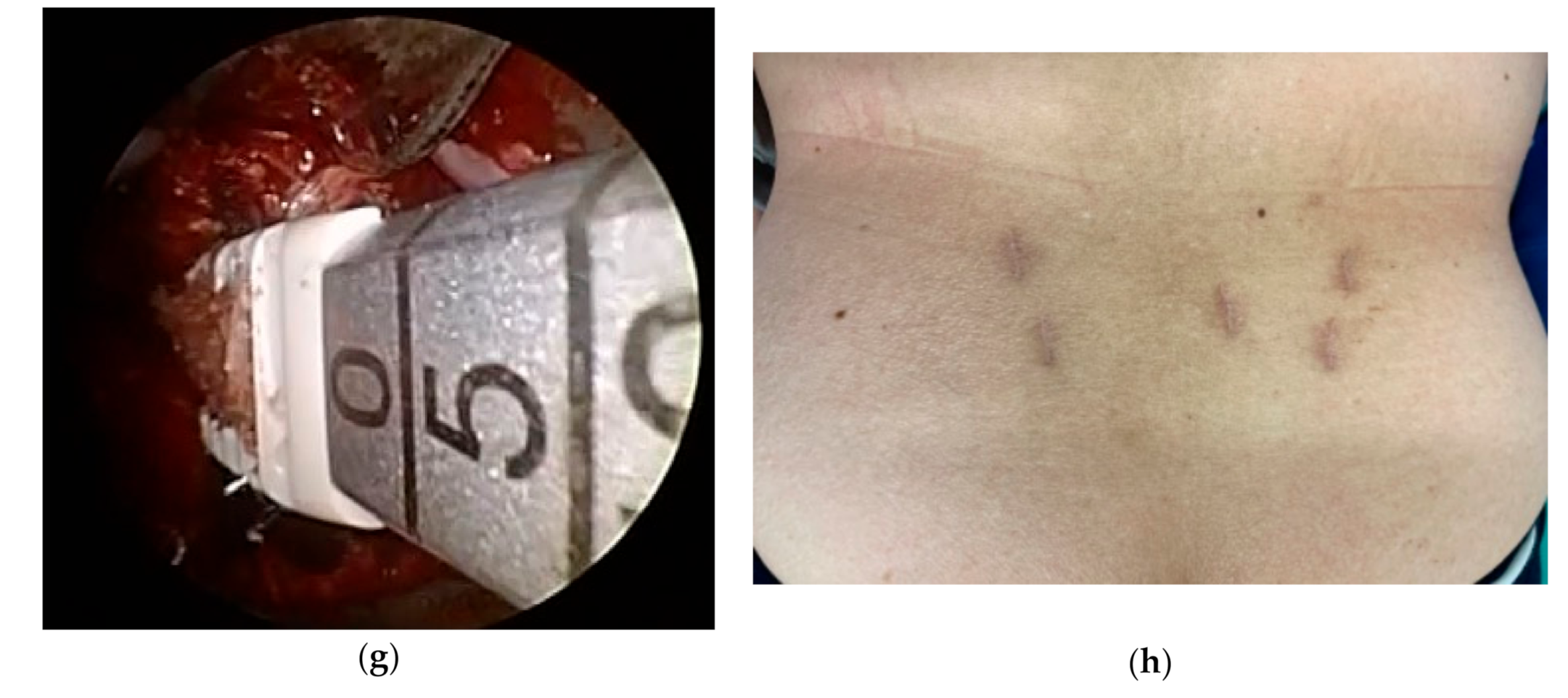 Medicina 57 00150 g001b Medicina 57 00150 g001b