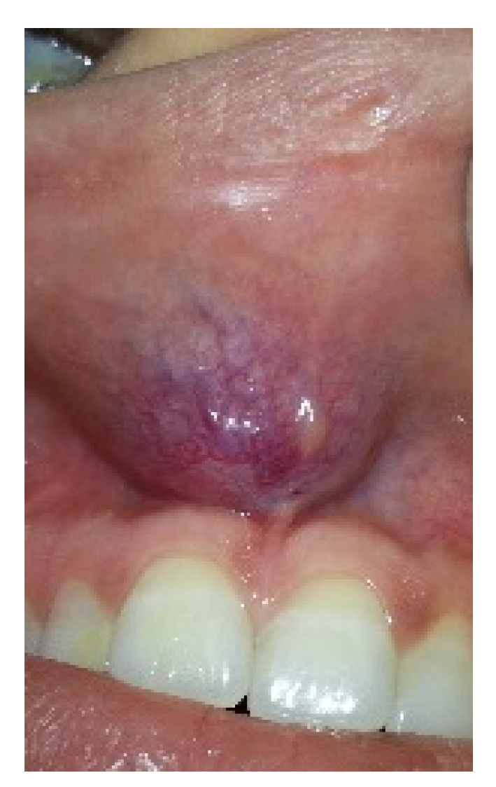 Medicina 57 00152 g001