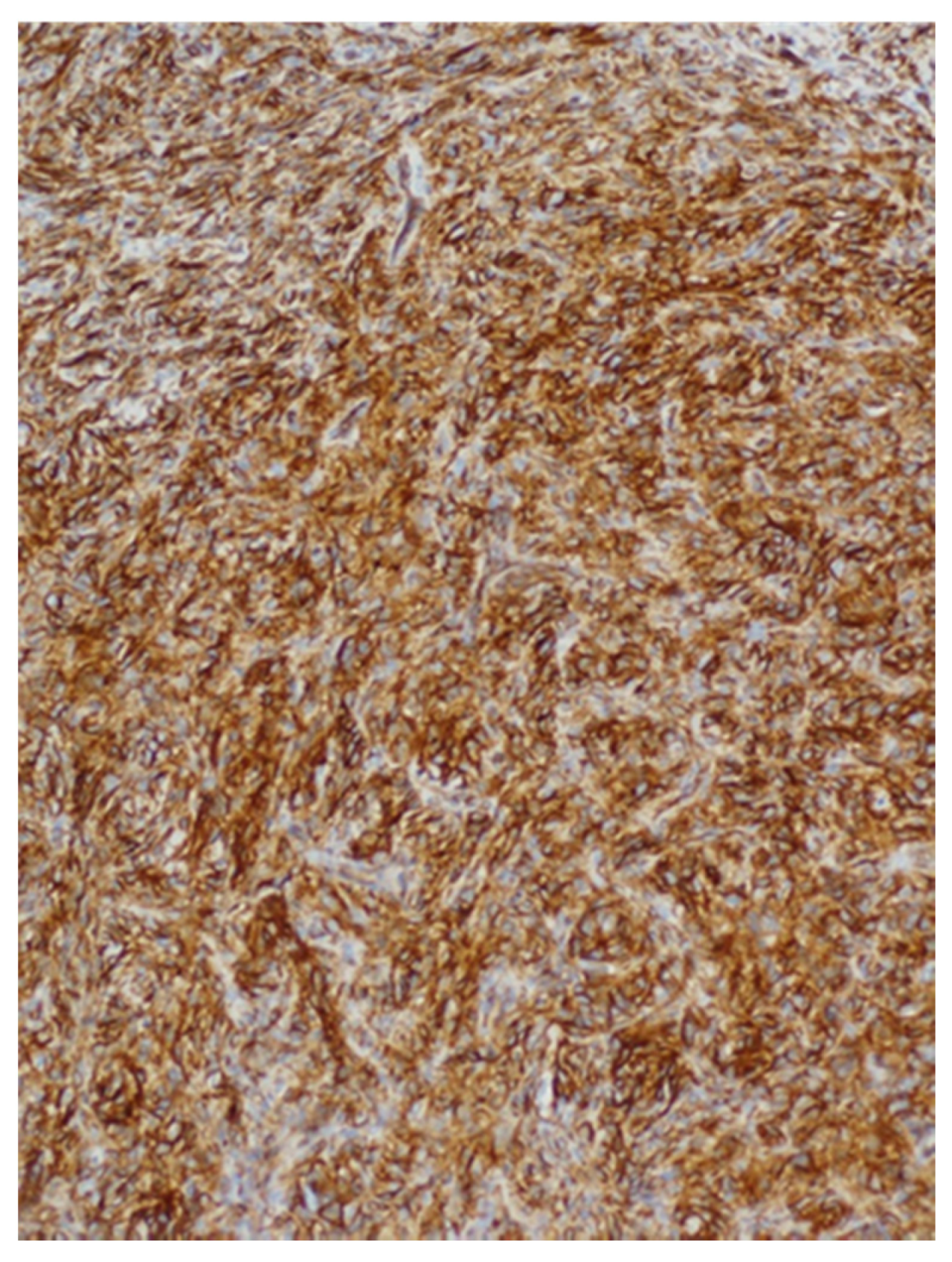 Medicina 57 00152 g005