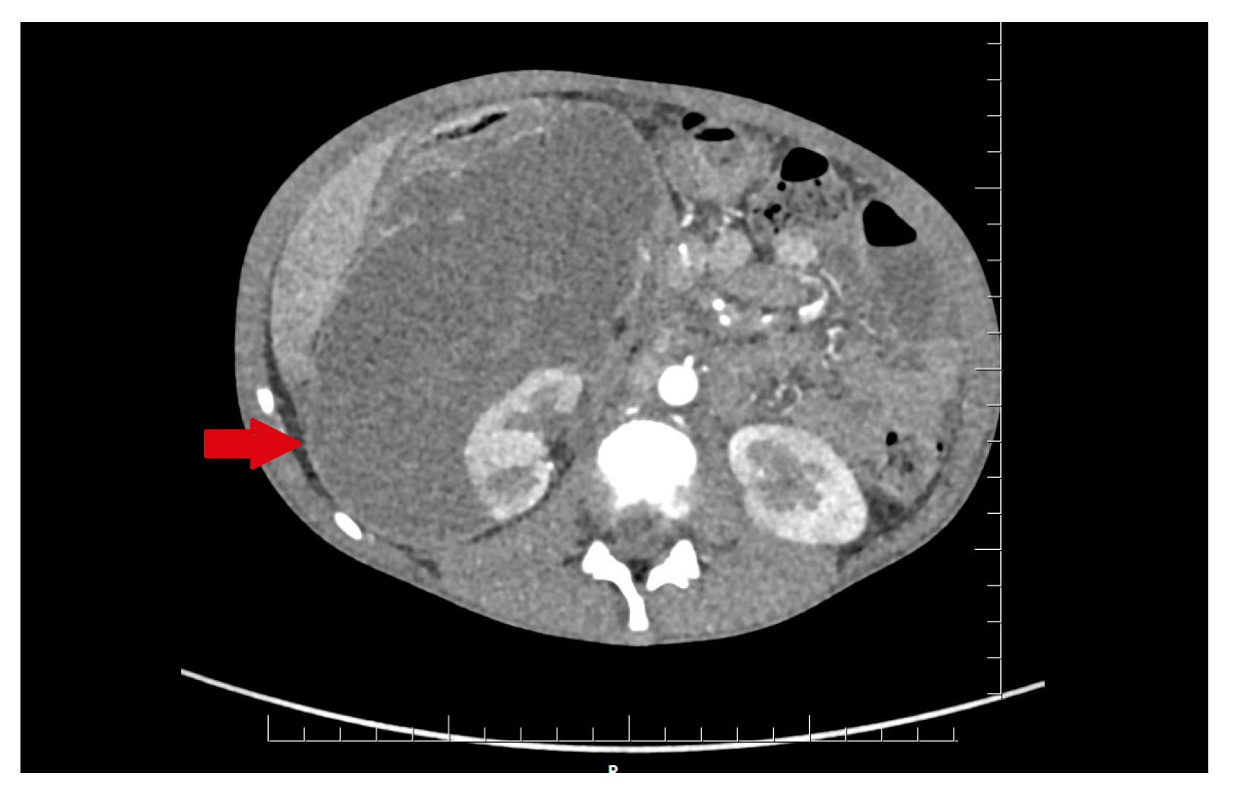 Medicina 57 00154 g001