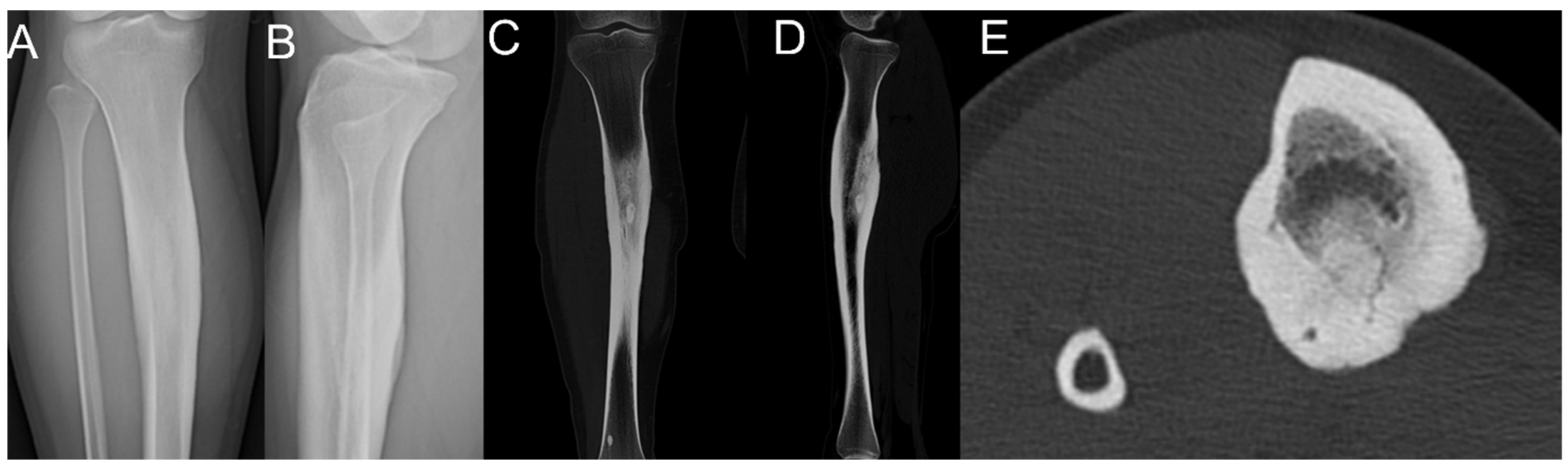 Medicina 57 00163 g002