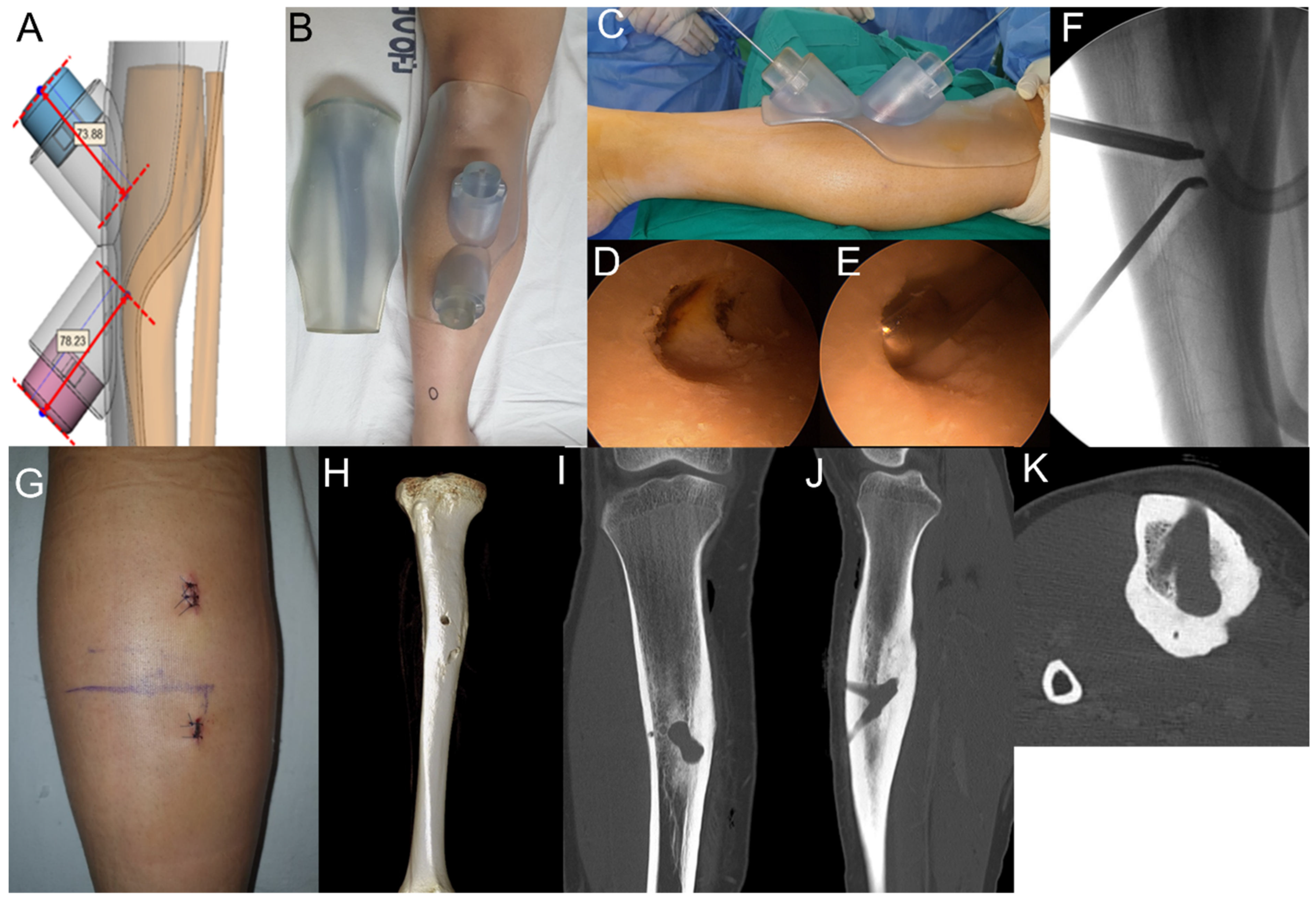 Medicina 57 00163 g003
