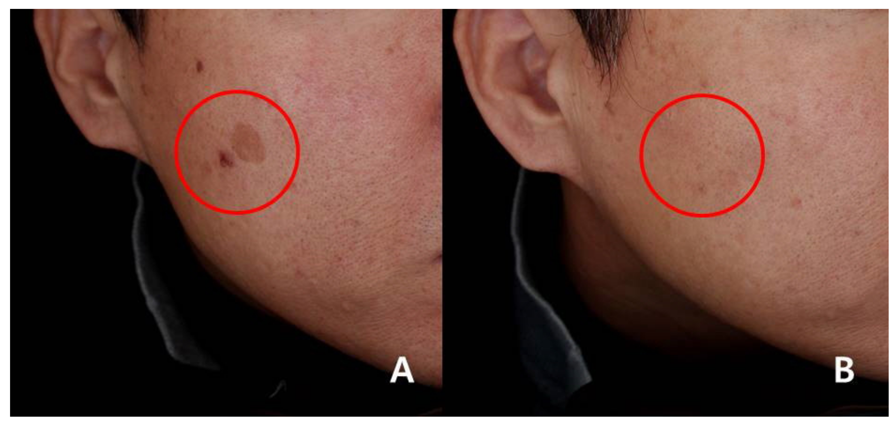 Medicina 57 00166 g003