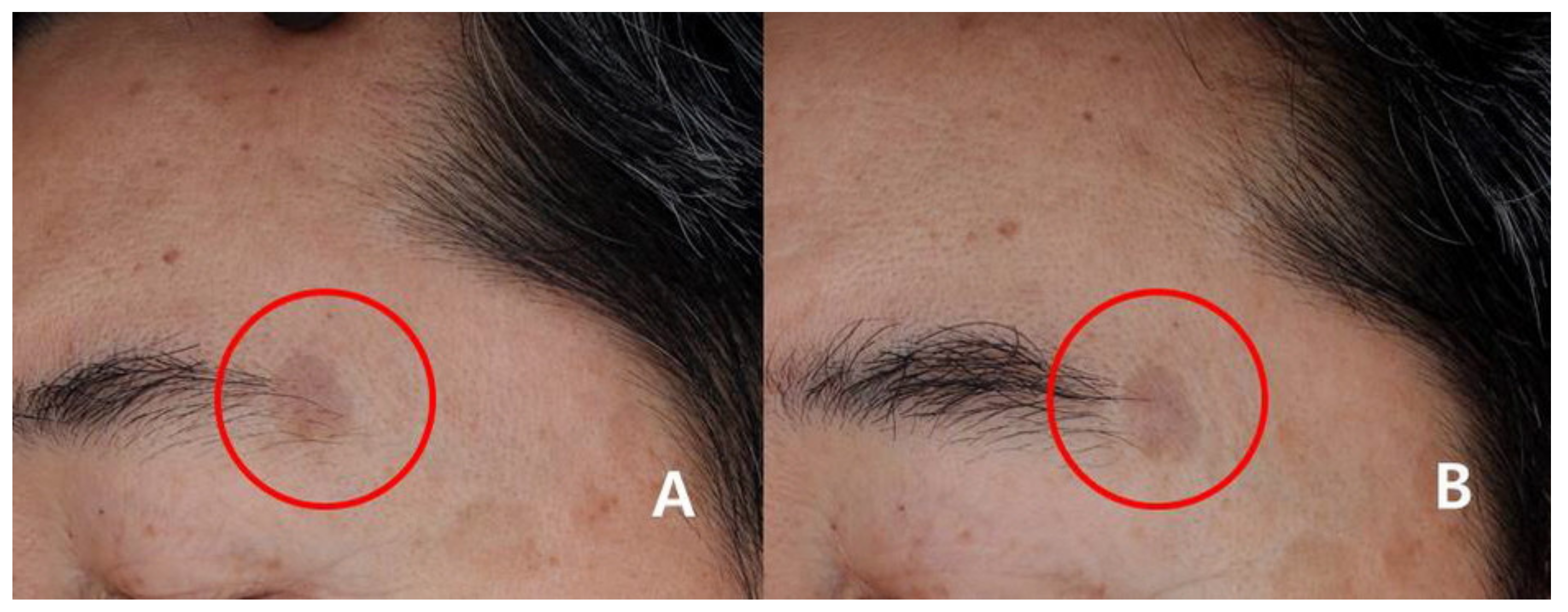 Medicina 57 00166 g004