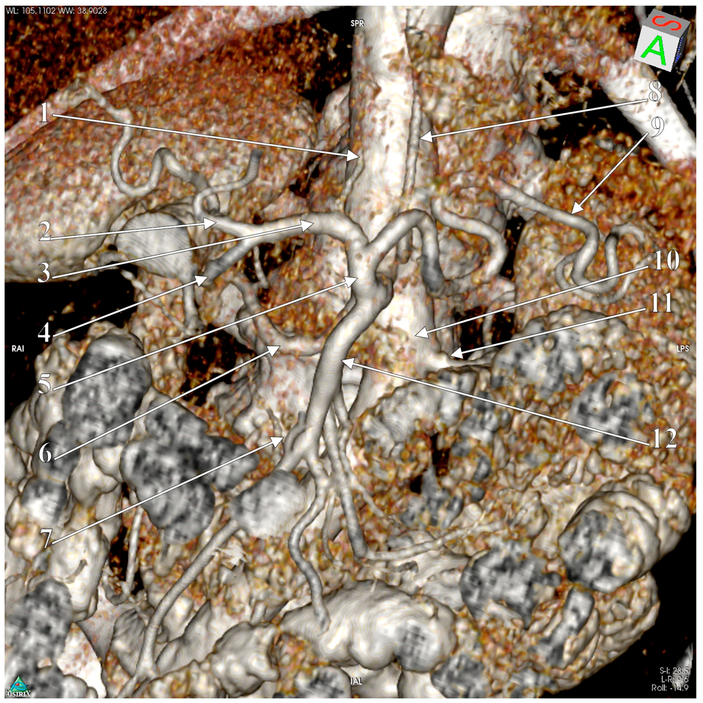 Medicina 57 00170 g001