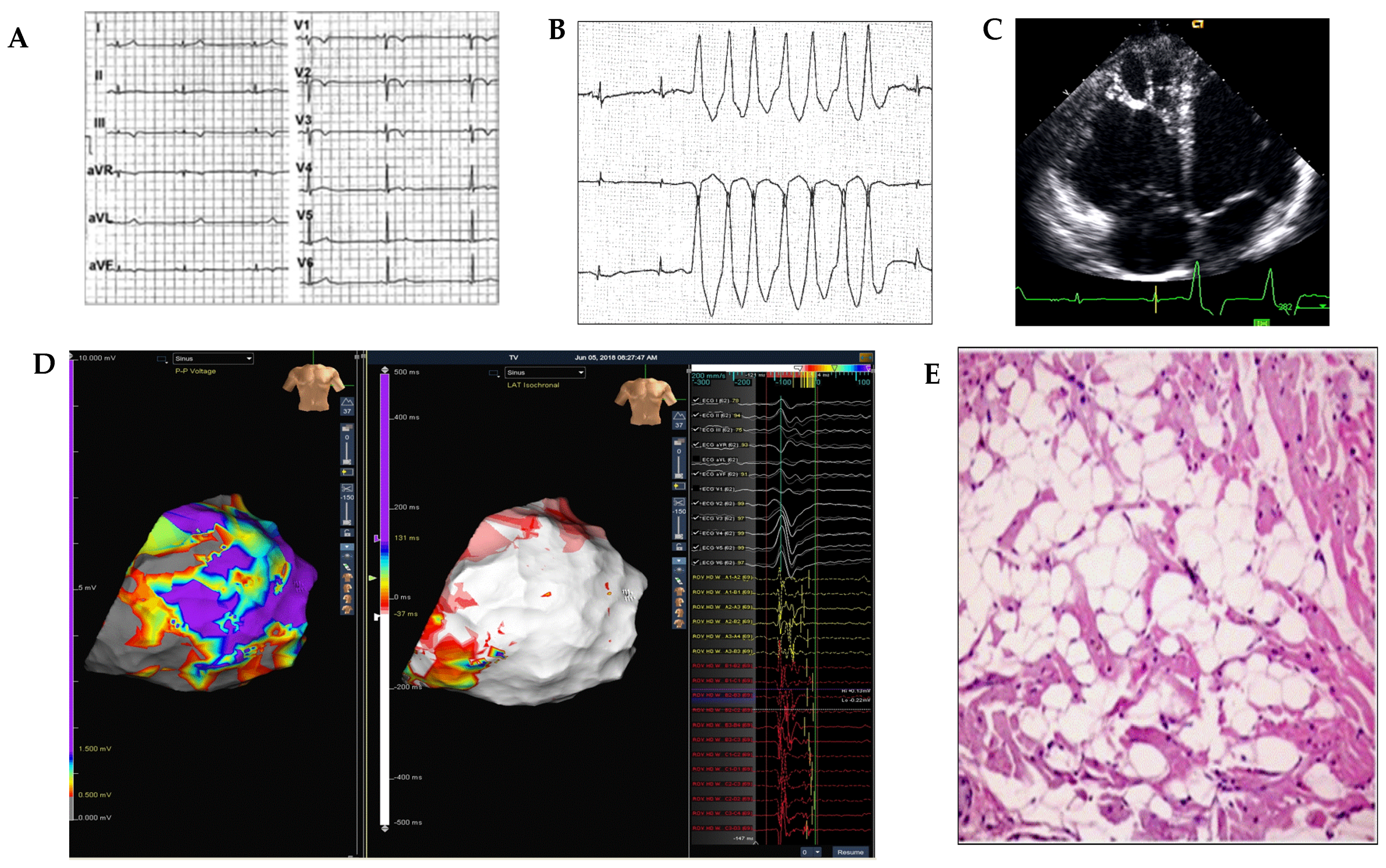 Medicina 57 00182 g001