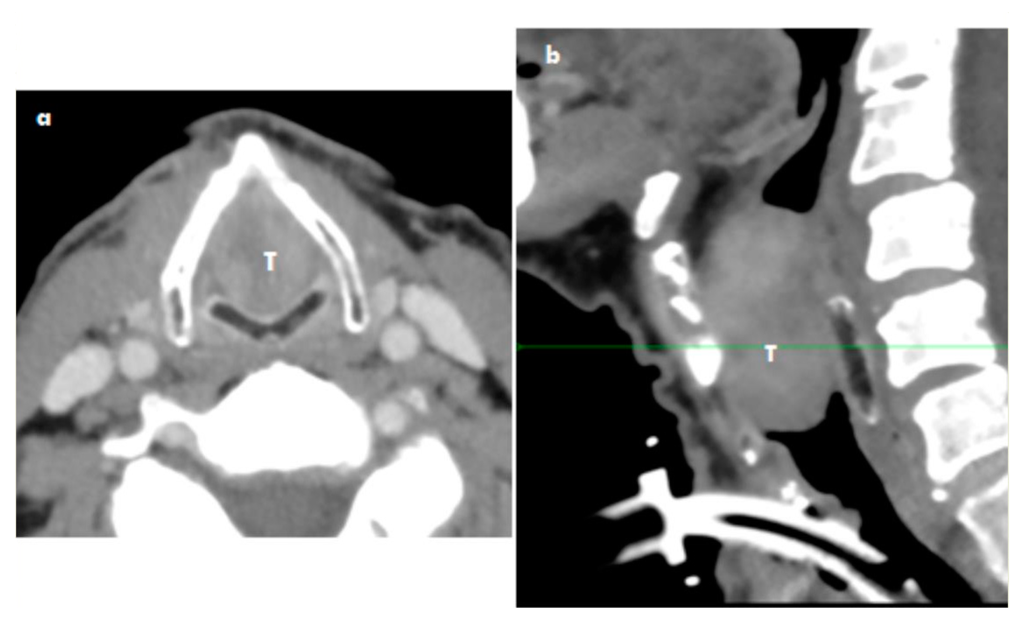 Medicina 57 00192 g002