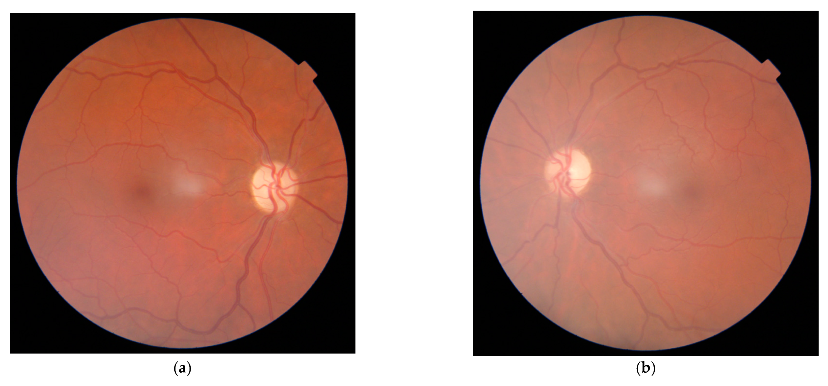 Medicina 57 00202 g002