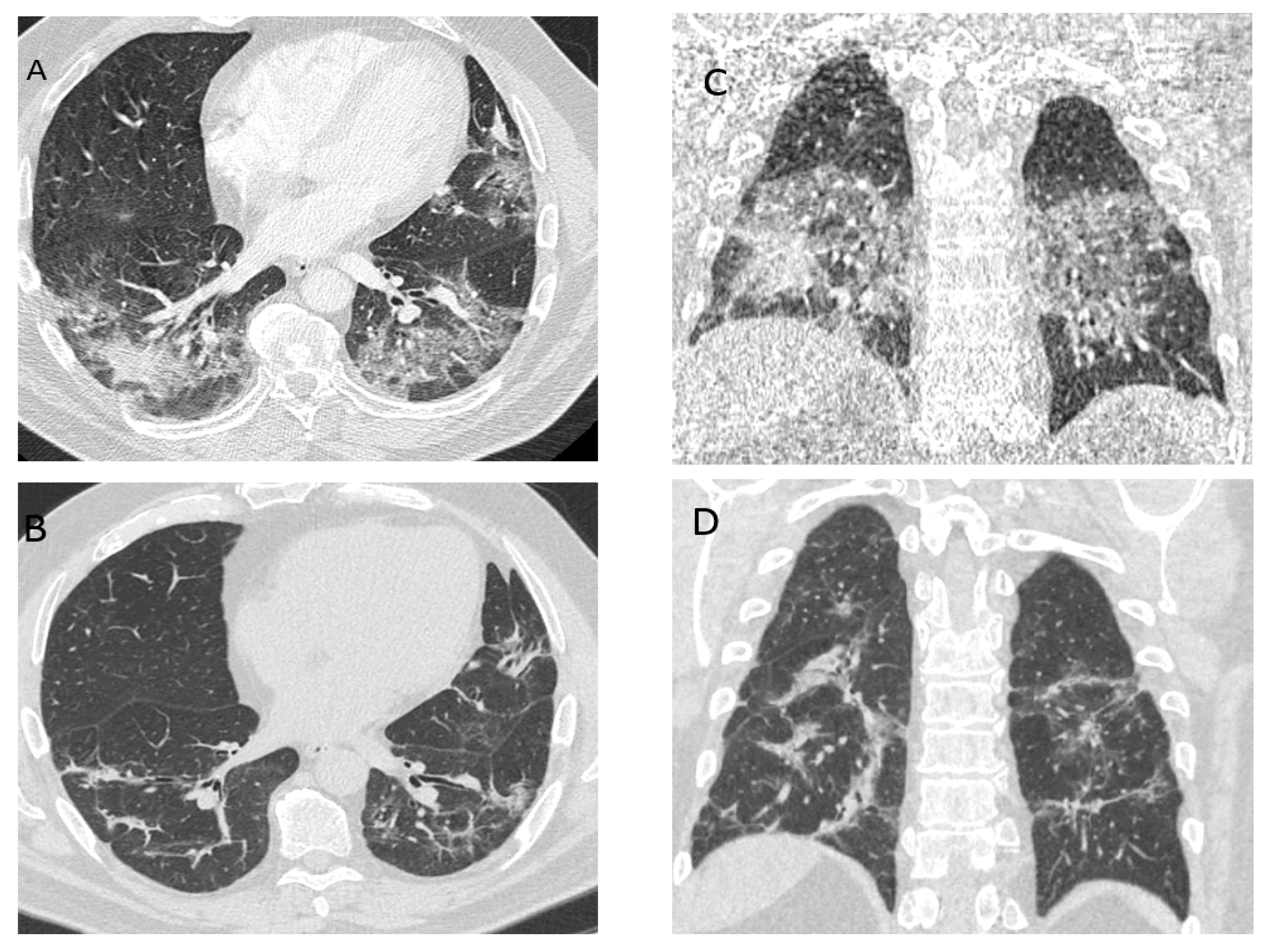 Medicina 57 00283 g002