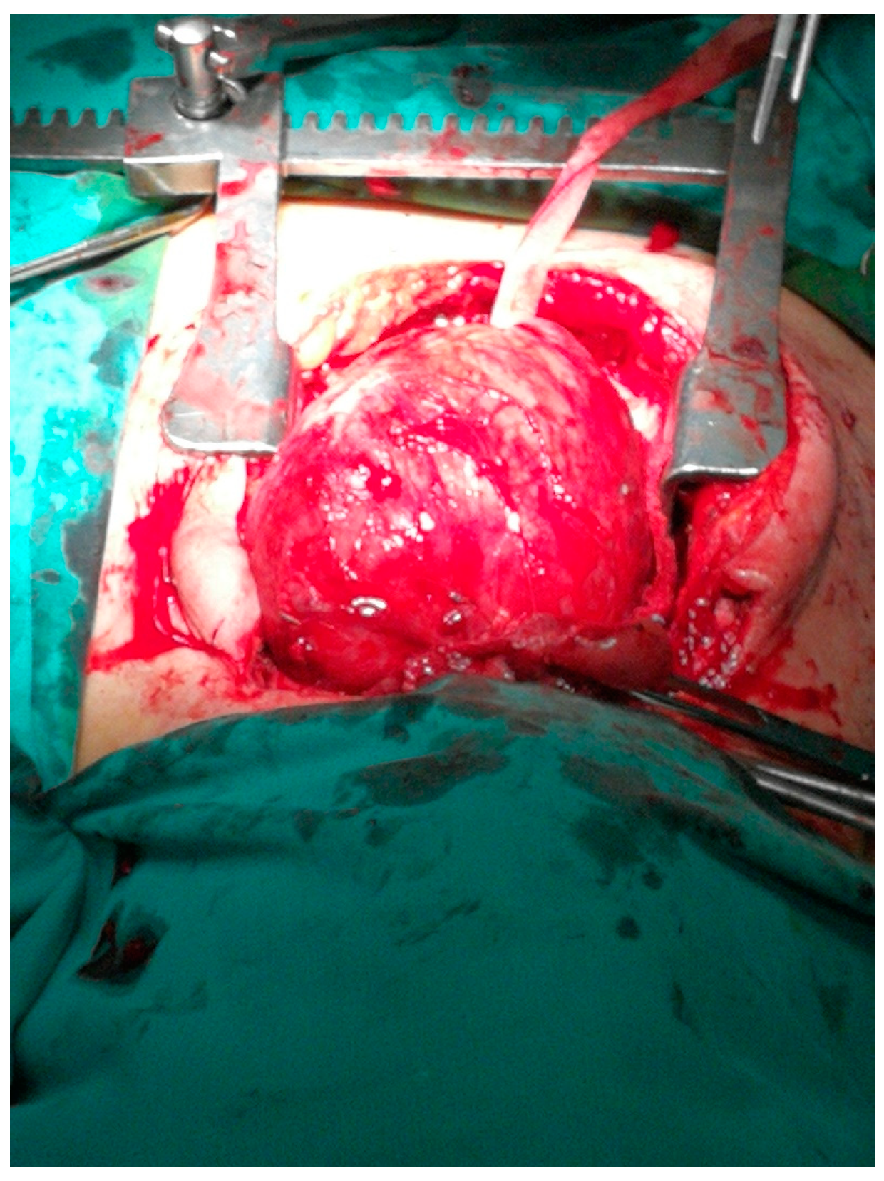 Medicina 57 00303 g004