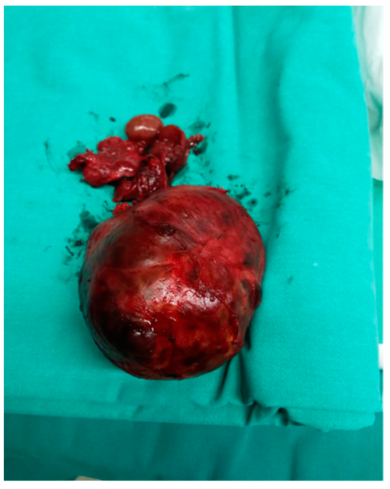 Medicina 57 00303 g006