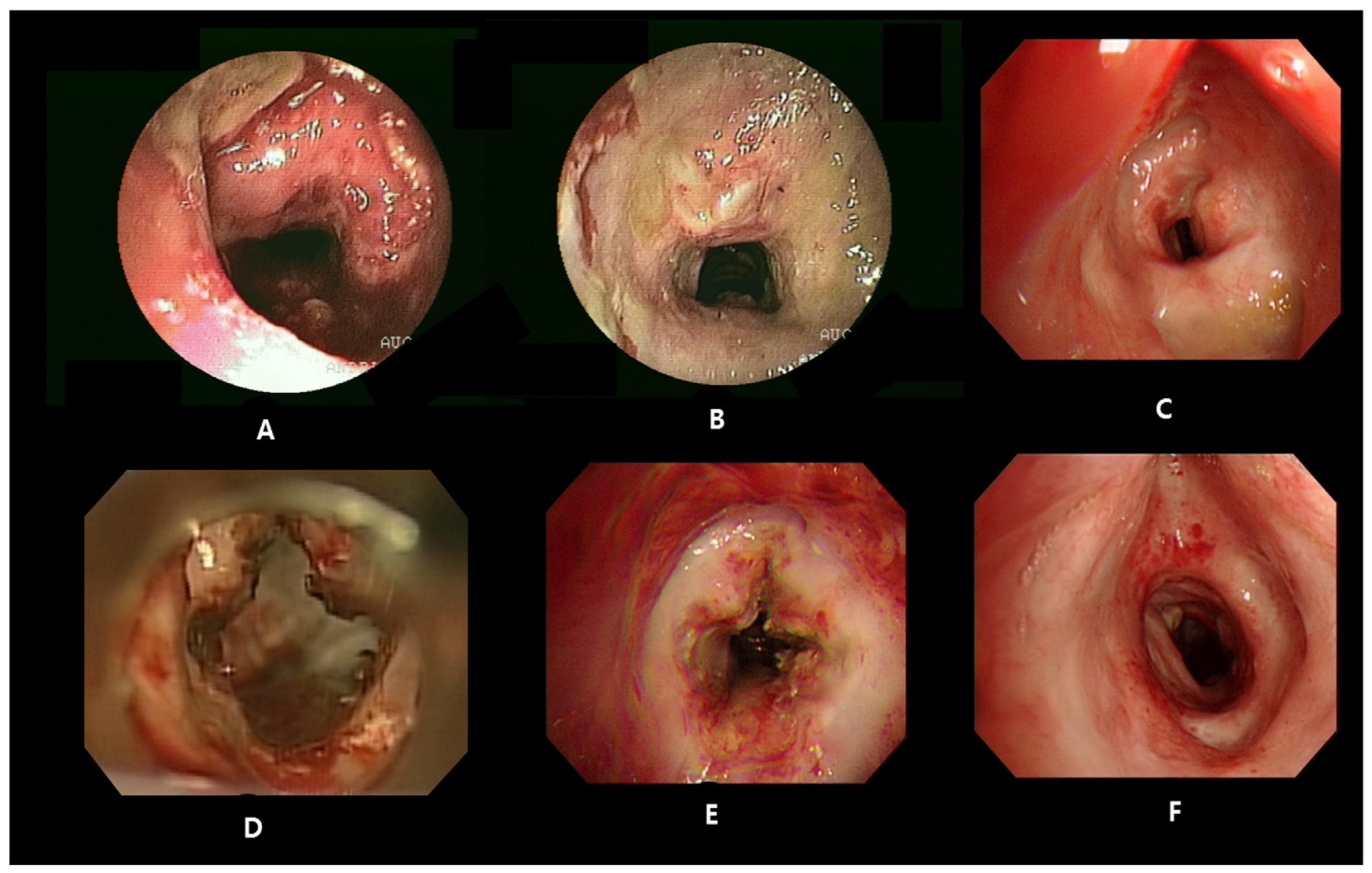 Medicina 57 00423 g003