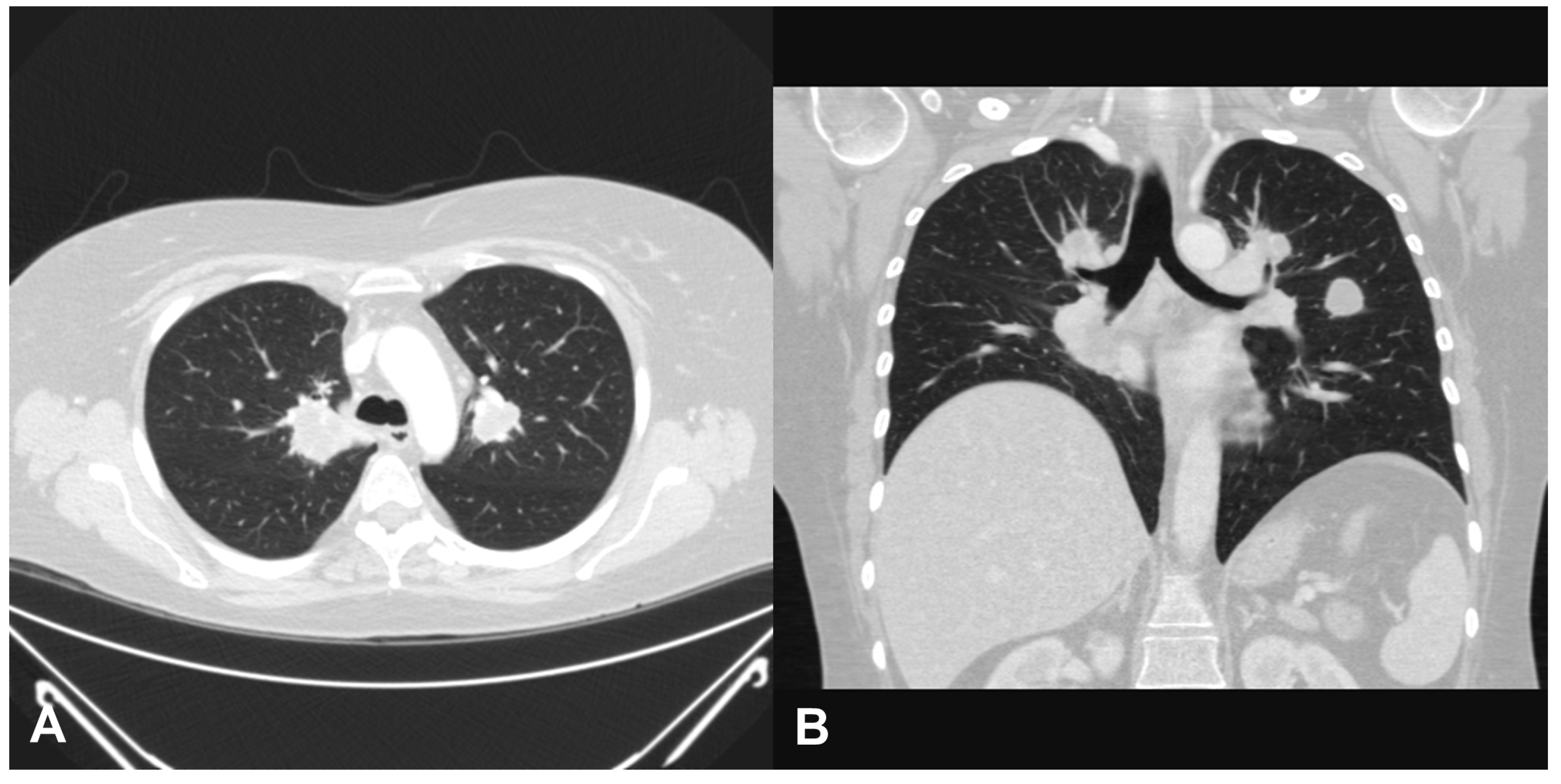 Medicina 57 00423 g004