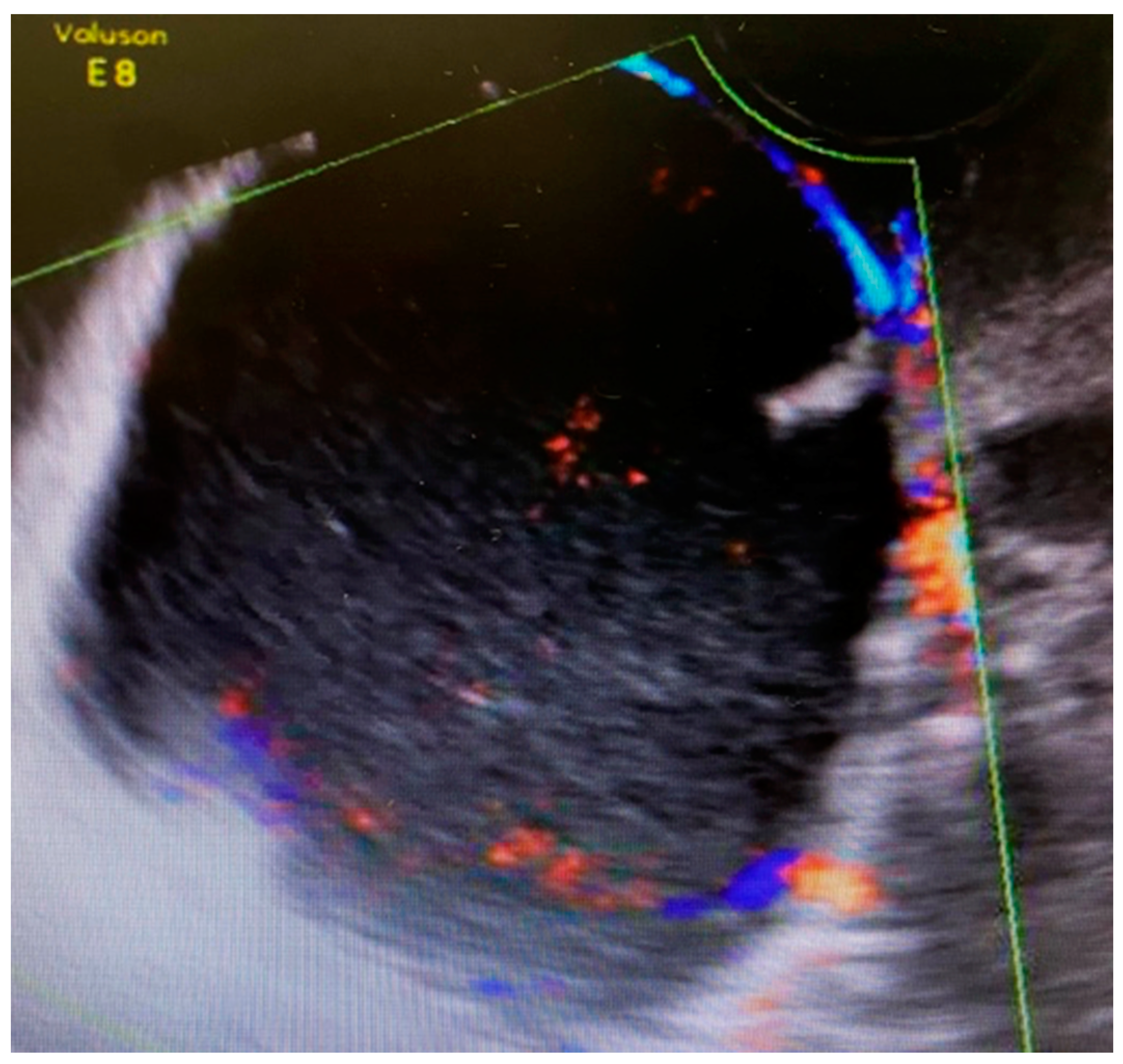 Medicina 57 00426 g001 Medicina 57 00426 g001