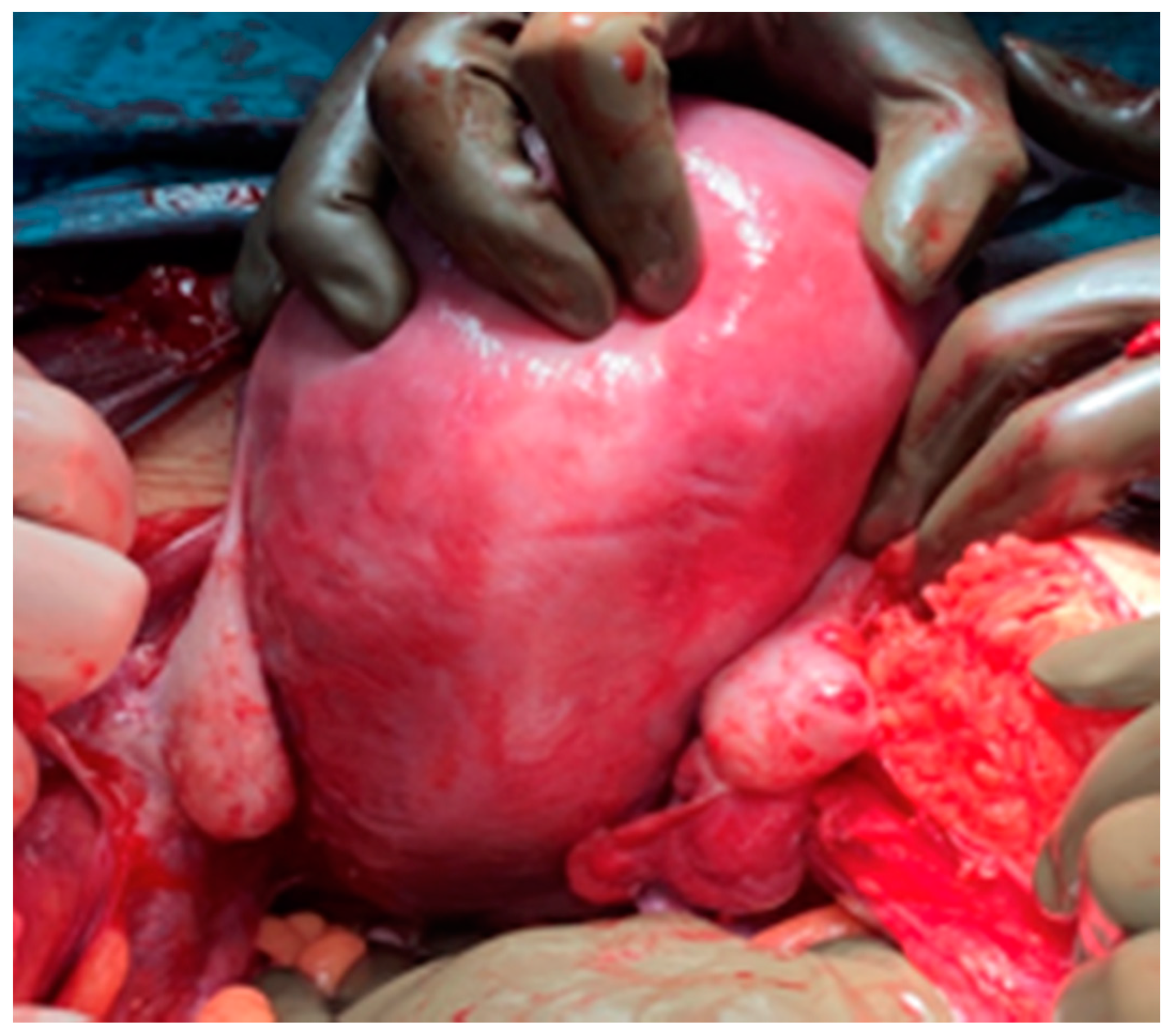 Medicina 57 00426 g004 Medicina 57 00426 g004