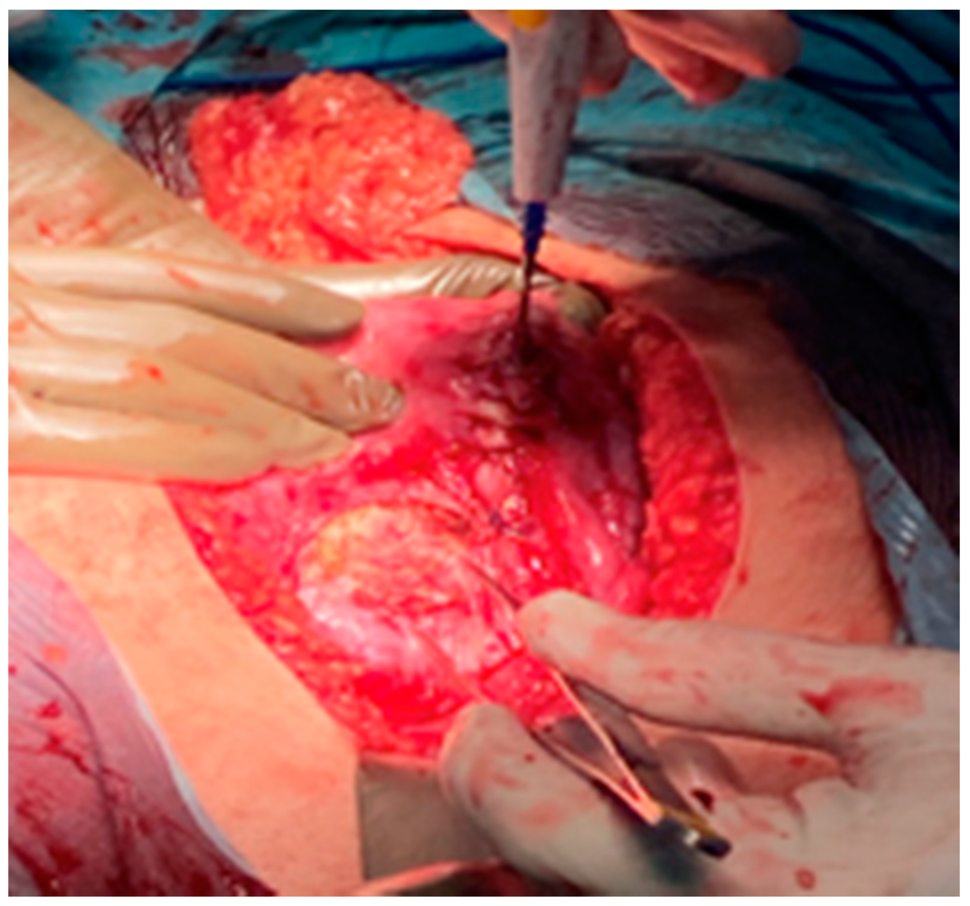 Medicina 57 00426 g005 Medicina 57 00426 g005