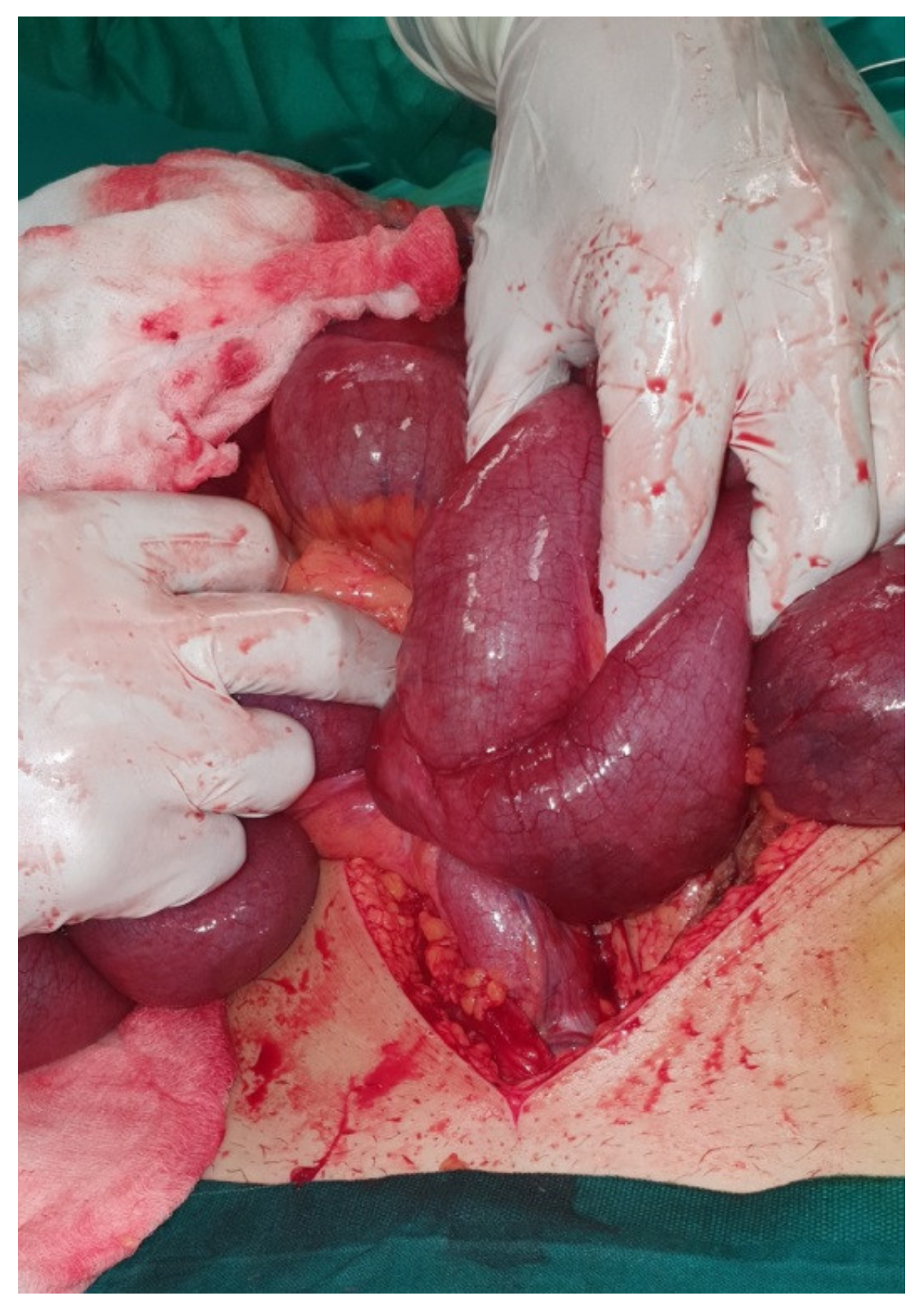 Medicina 57 00443 g001 Medicina 57 00443 g001