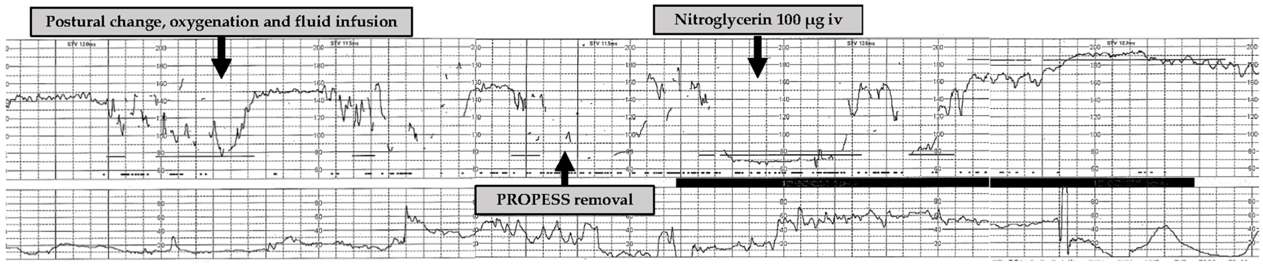 Medicina 57 00478 g001