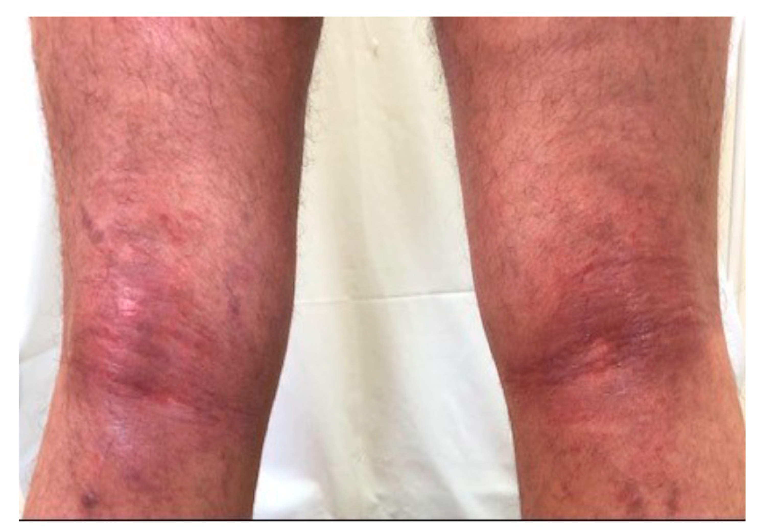 Medicina 57 00521 g001