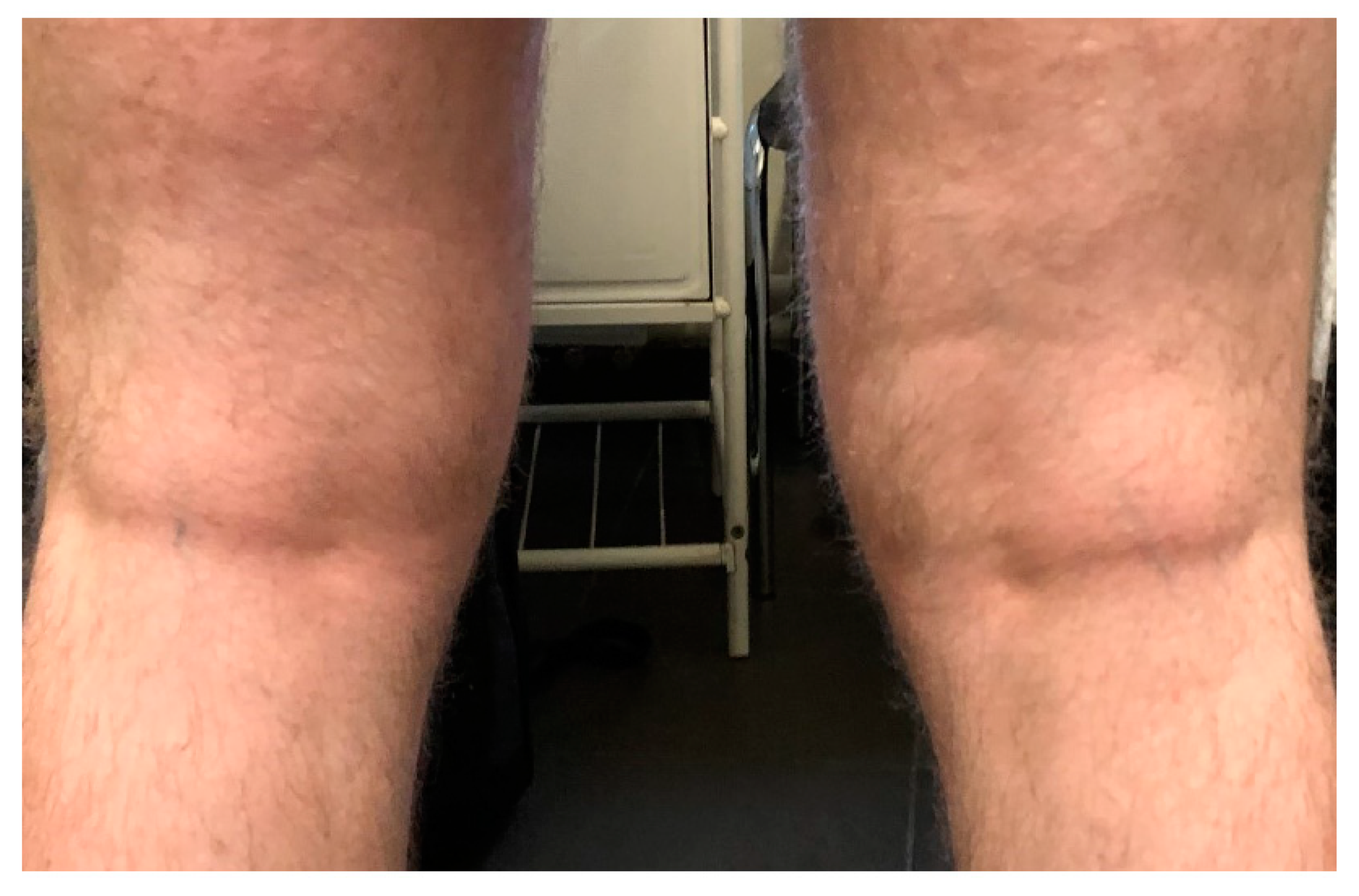 Medicina 57 00521 g002