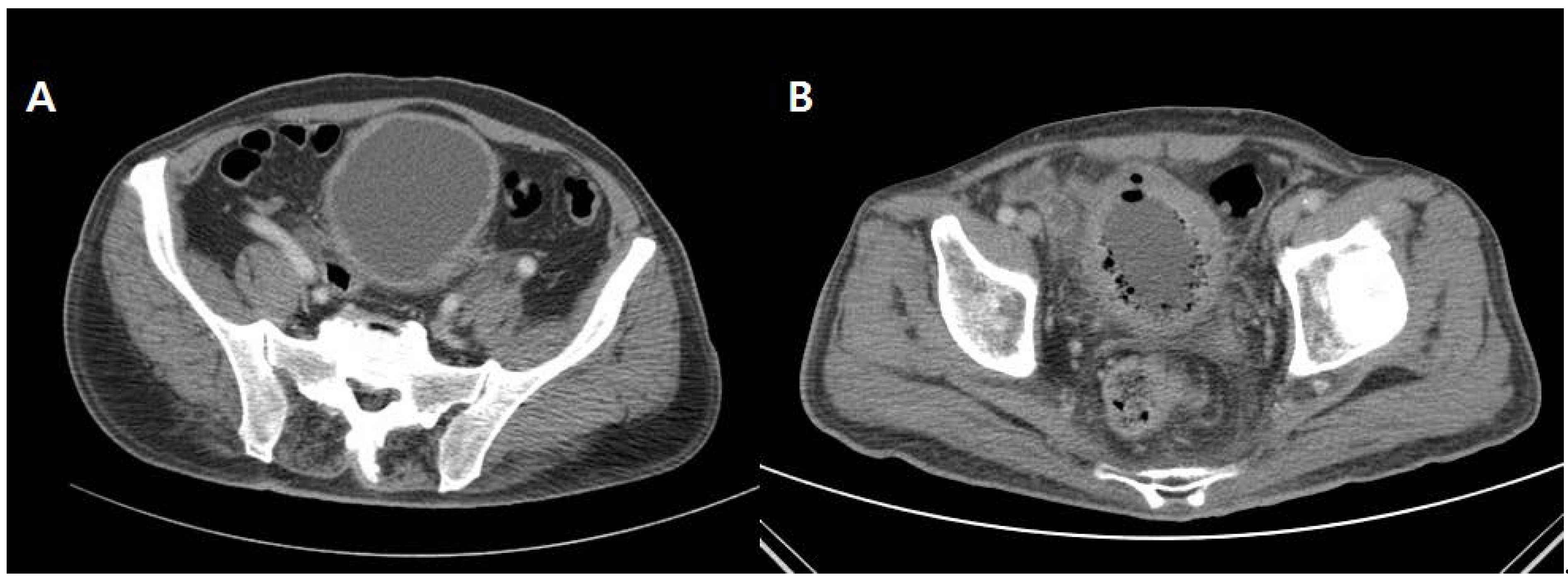 Medicina 57 00531 g001