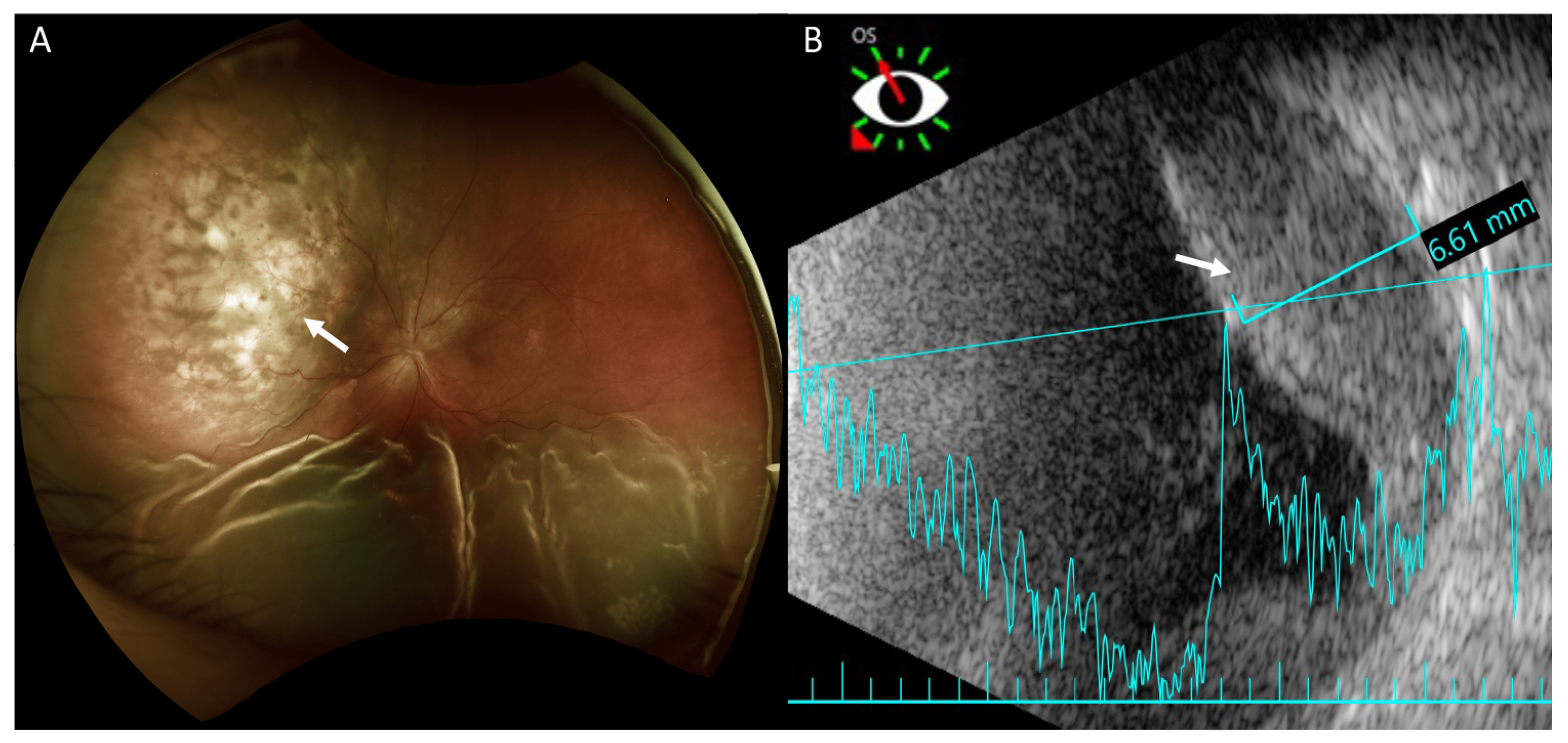 Medicina 57 00539 g002