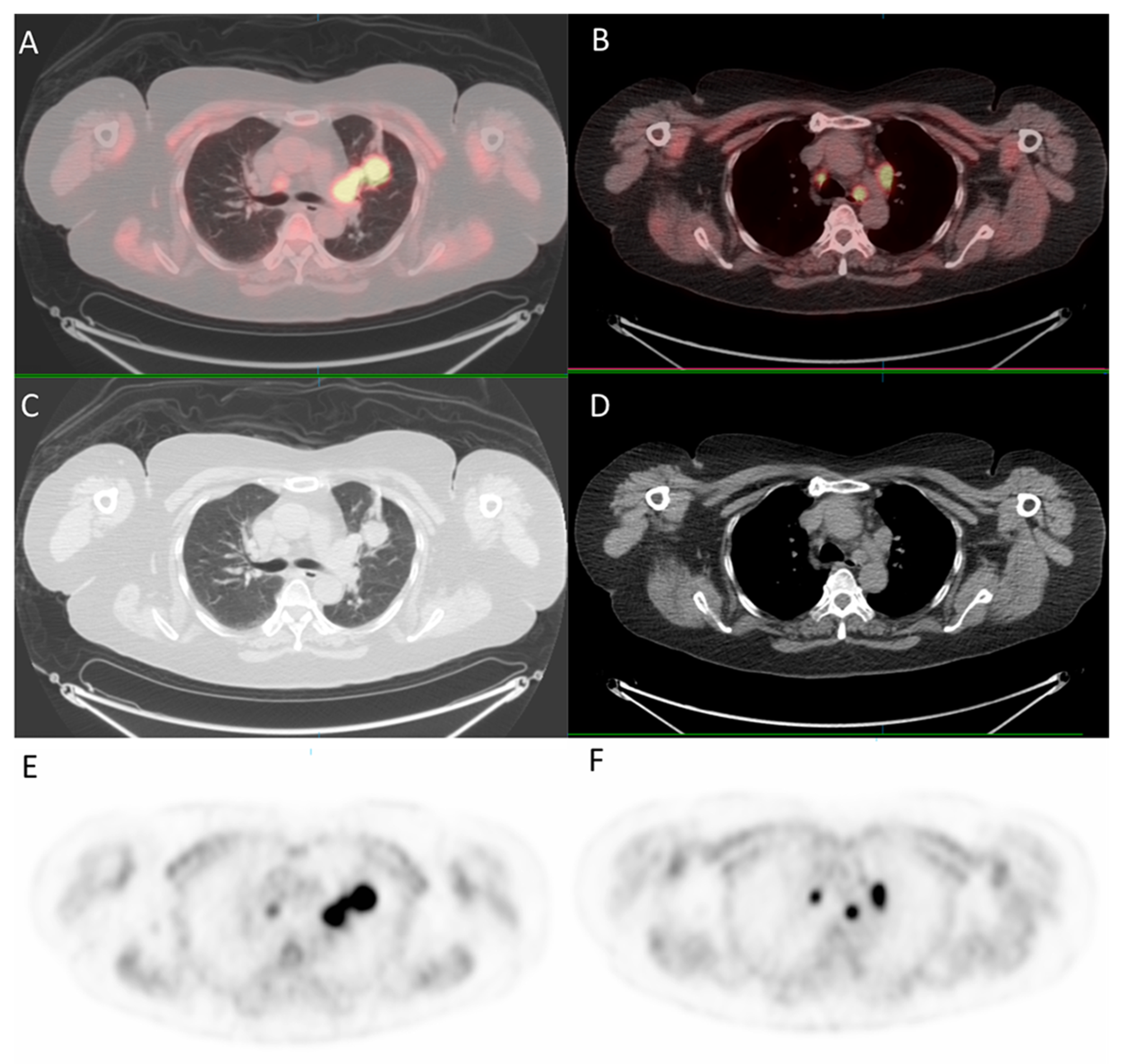 Medicina 57 00539 g005