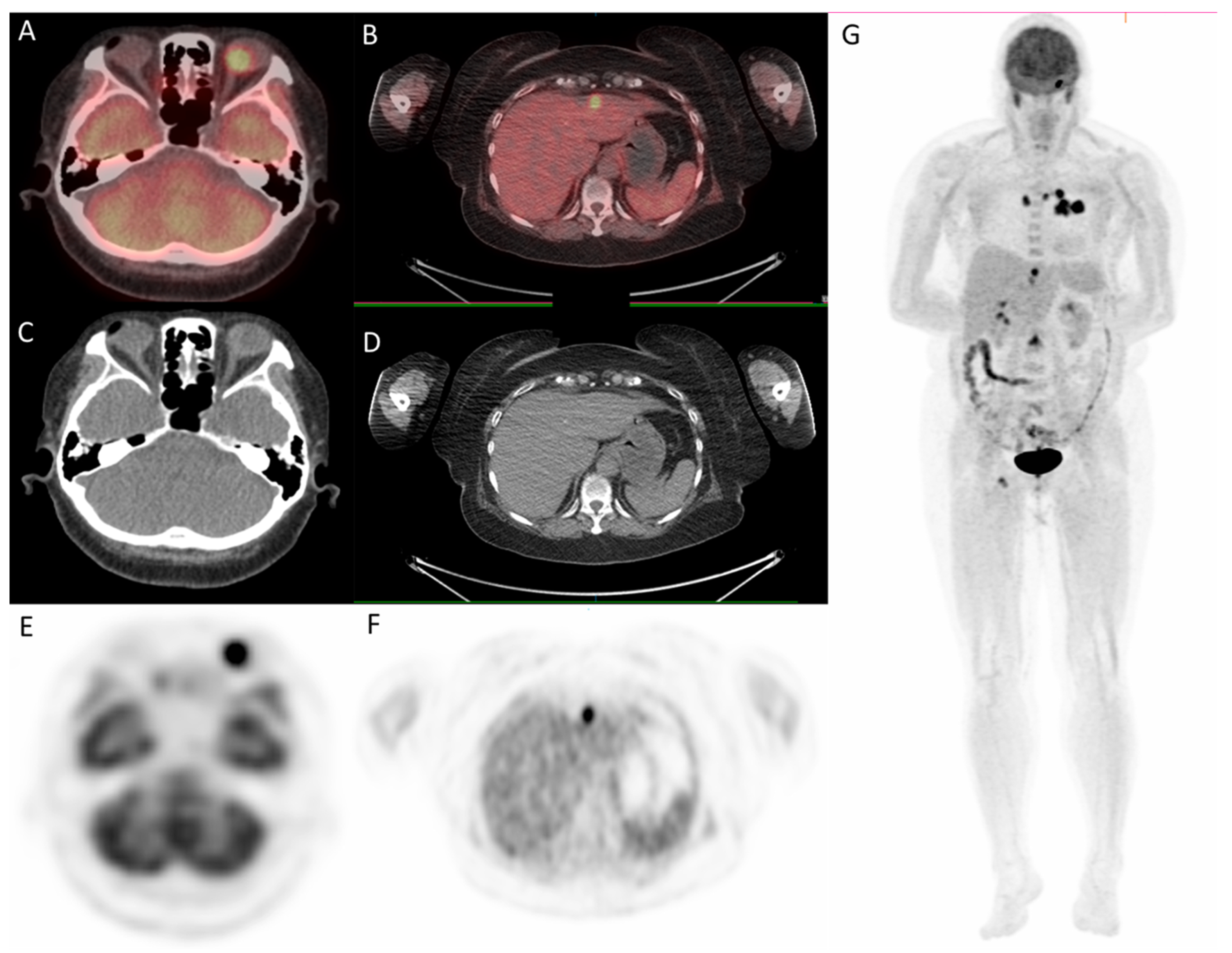 Medicina 57 00539 g006