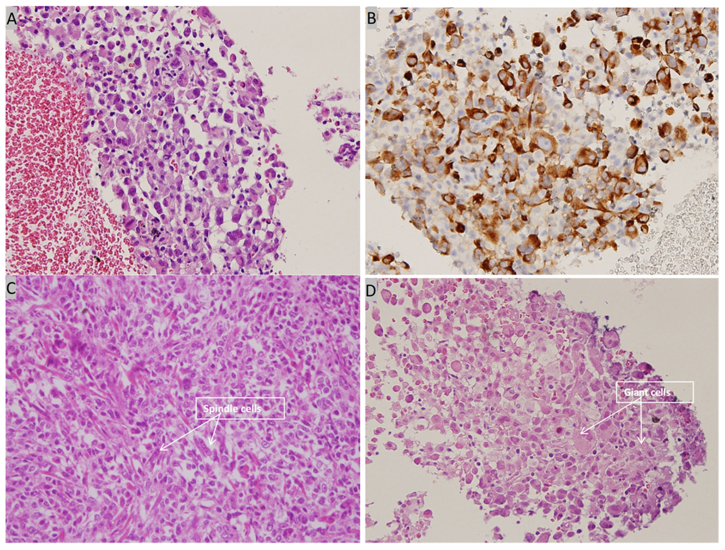 Medicina 57 00539 g007