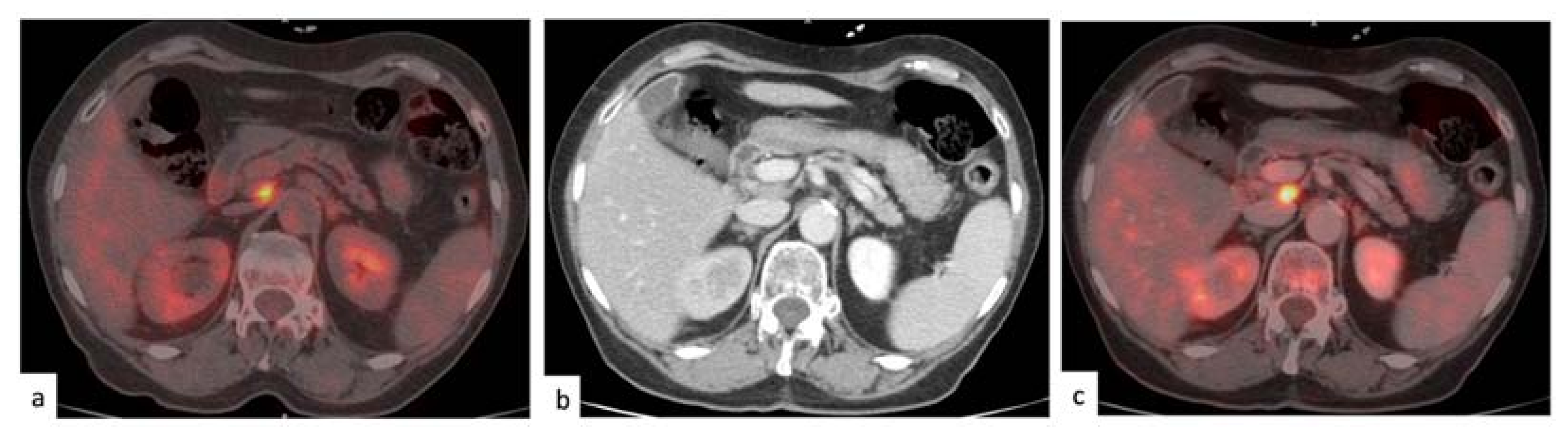 Medicina 57 00561 g002