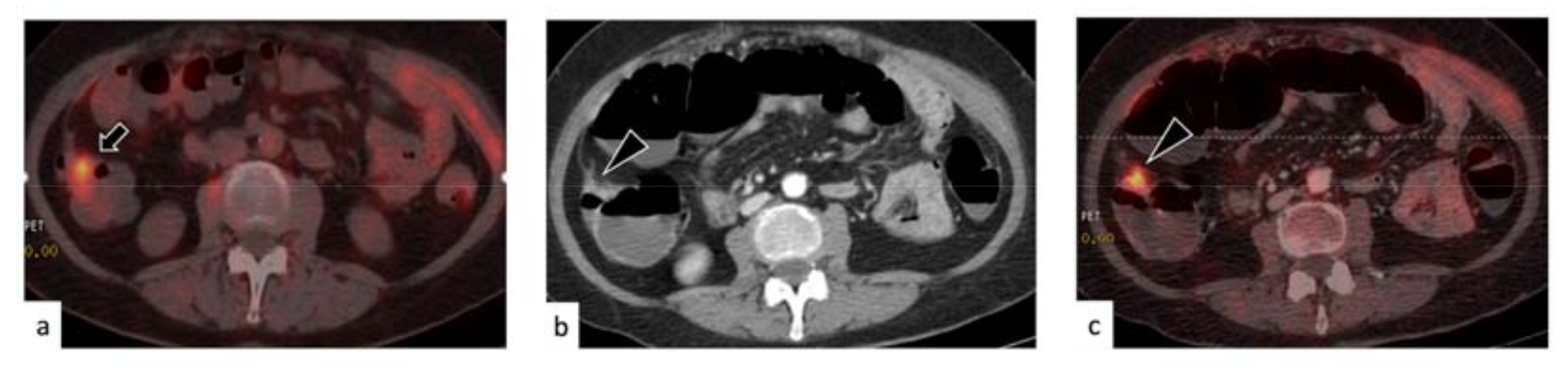 Medicina 57 00561 g003