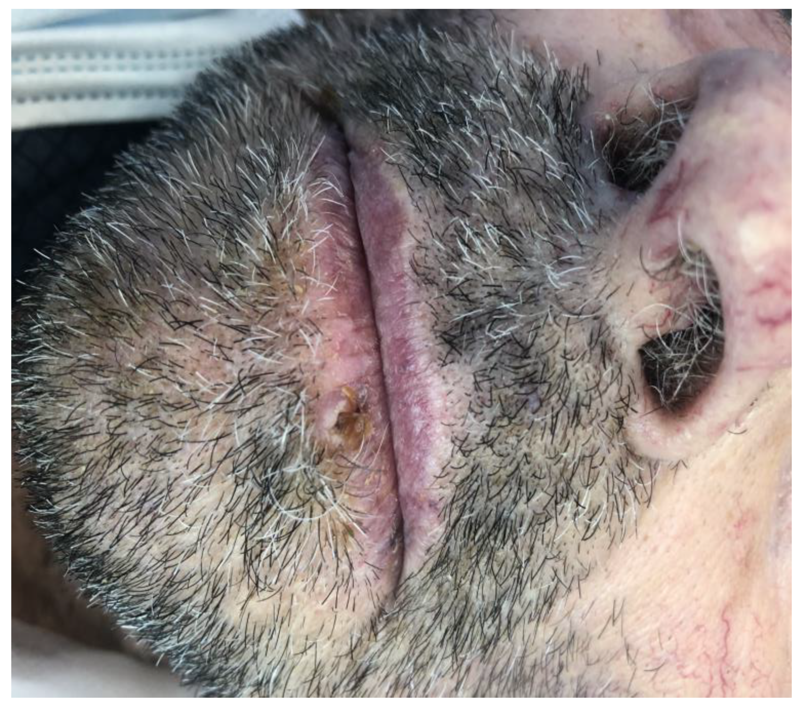 Medicina 57 00563 g001 Medicina 57 00563 g001