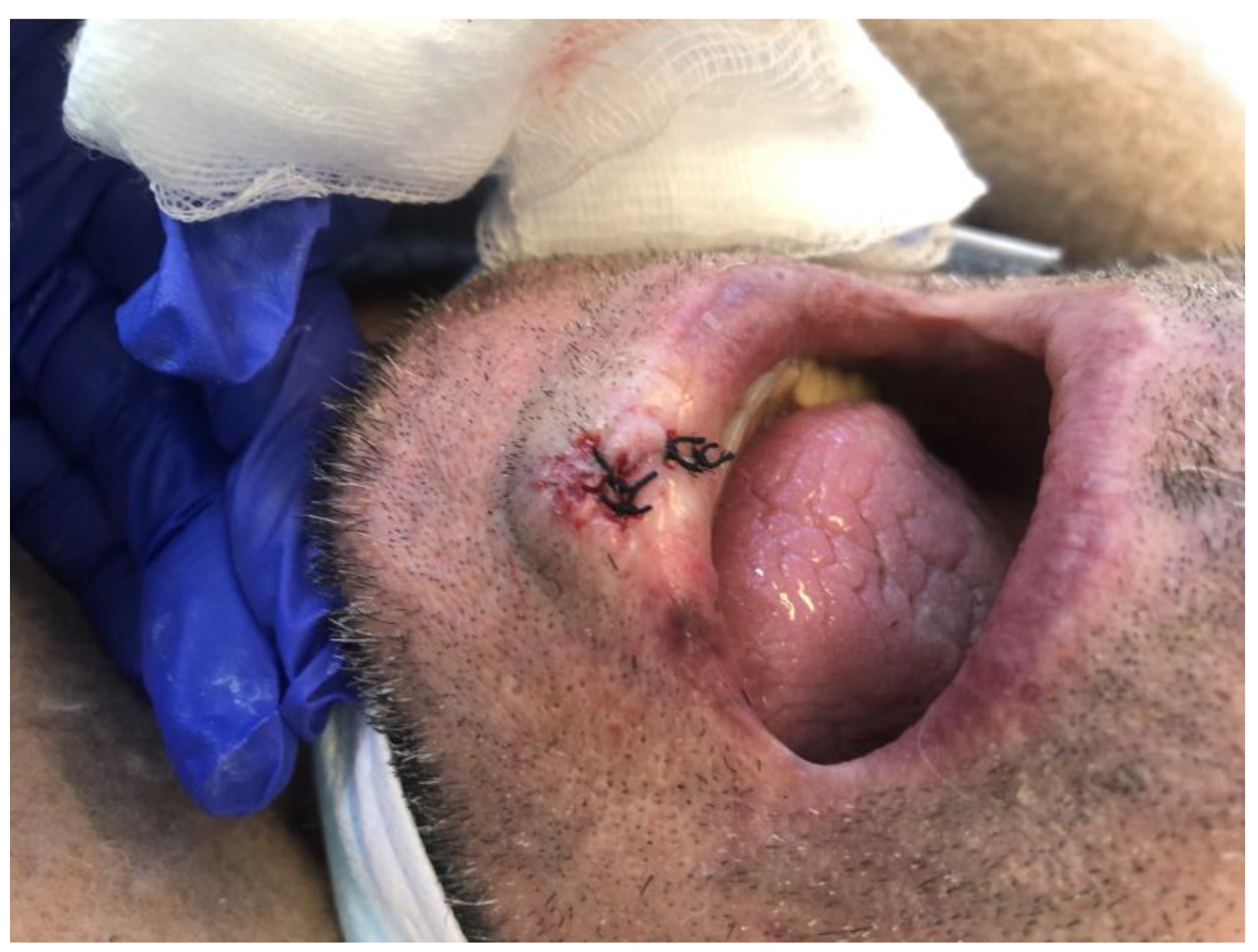 Medicina 57 00563 g002 Medicina 57 00563 g002