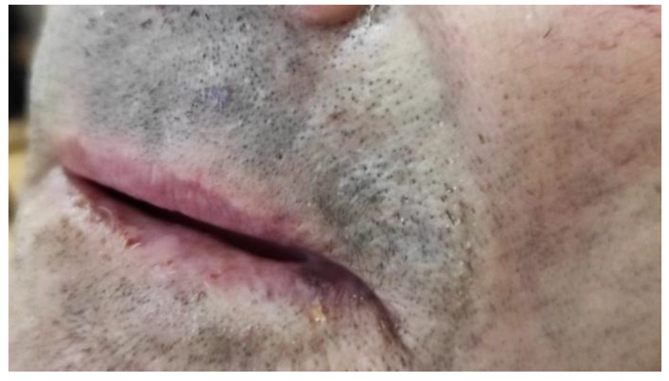 Medicina 57 00563 g003 Medicina 57 00563 g003