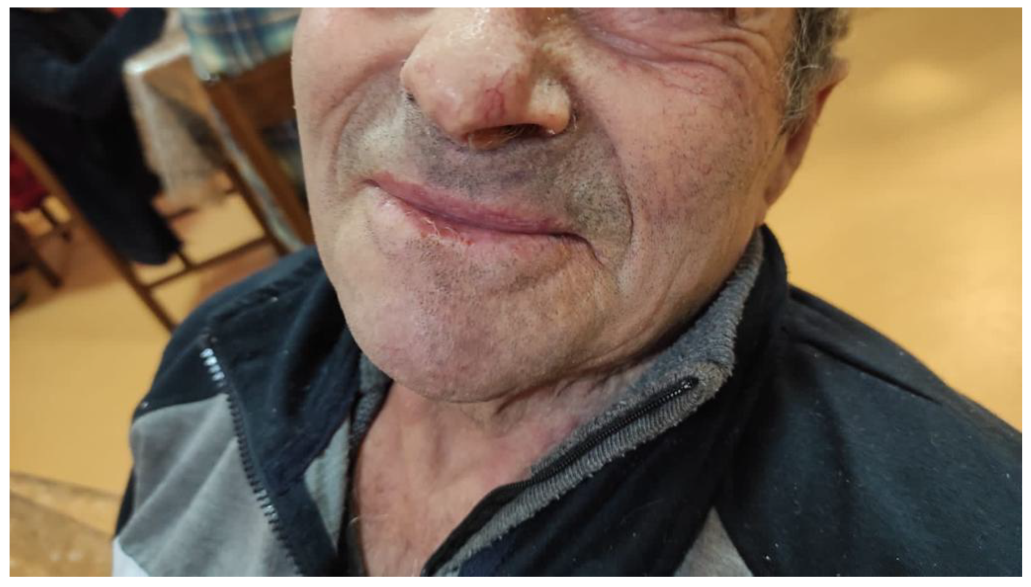 Medicina 57 00563 g004 Medicina 57 00563 g004