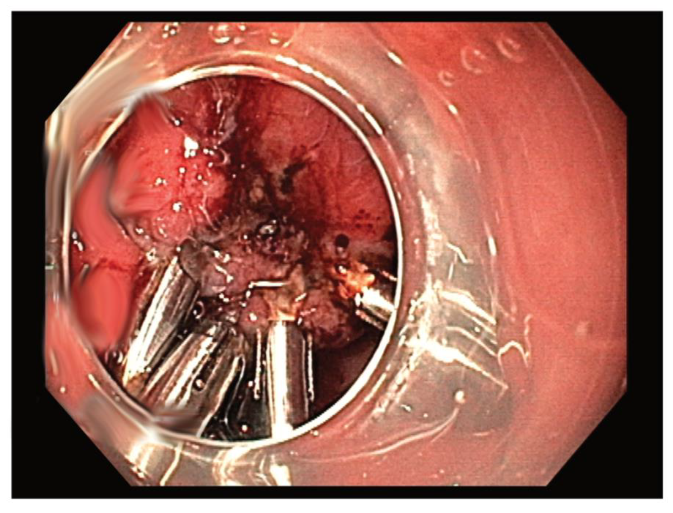 Medicina 57 00625 g002