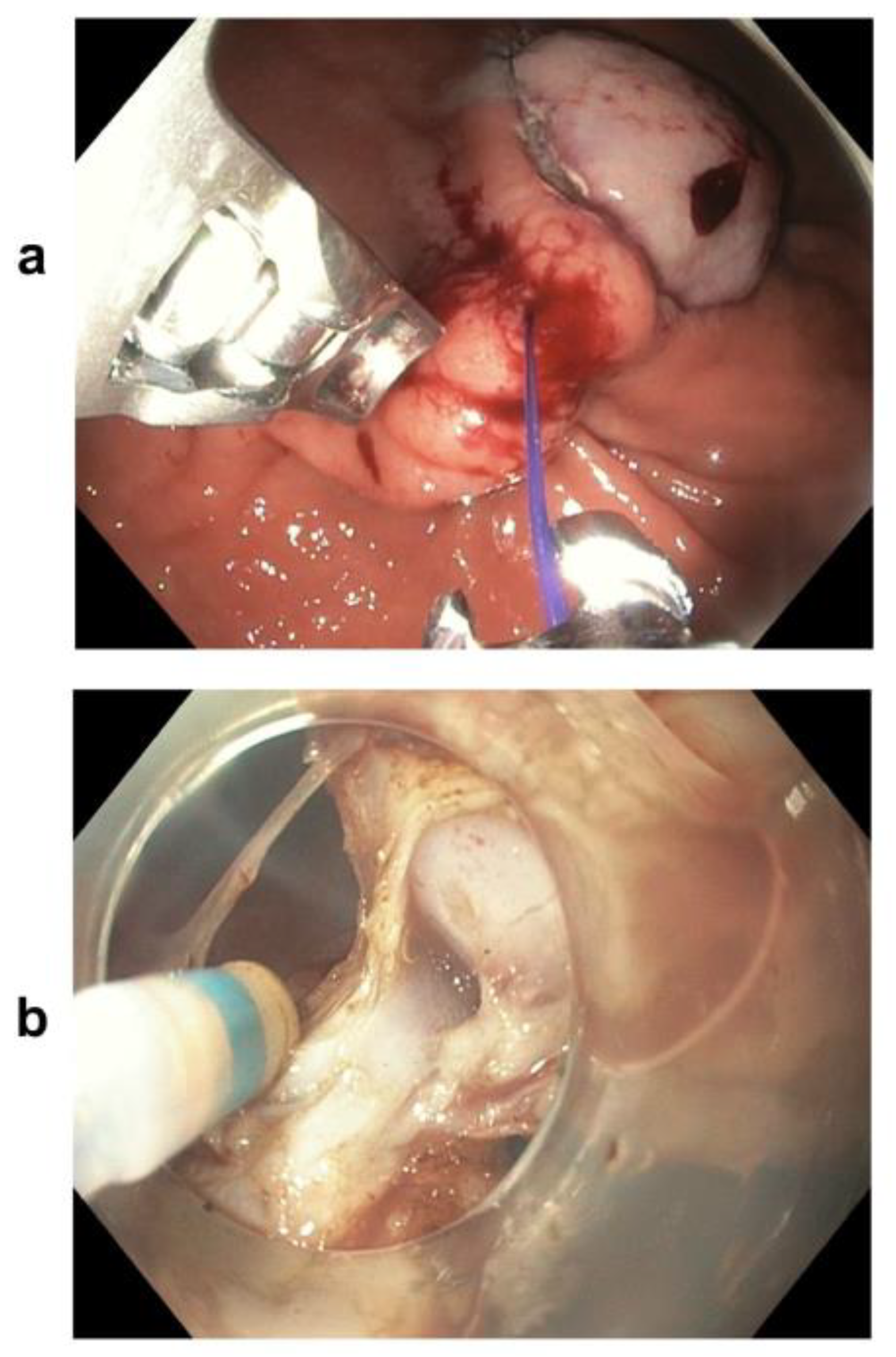 Medicina 57 00625 g003