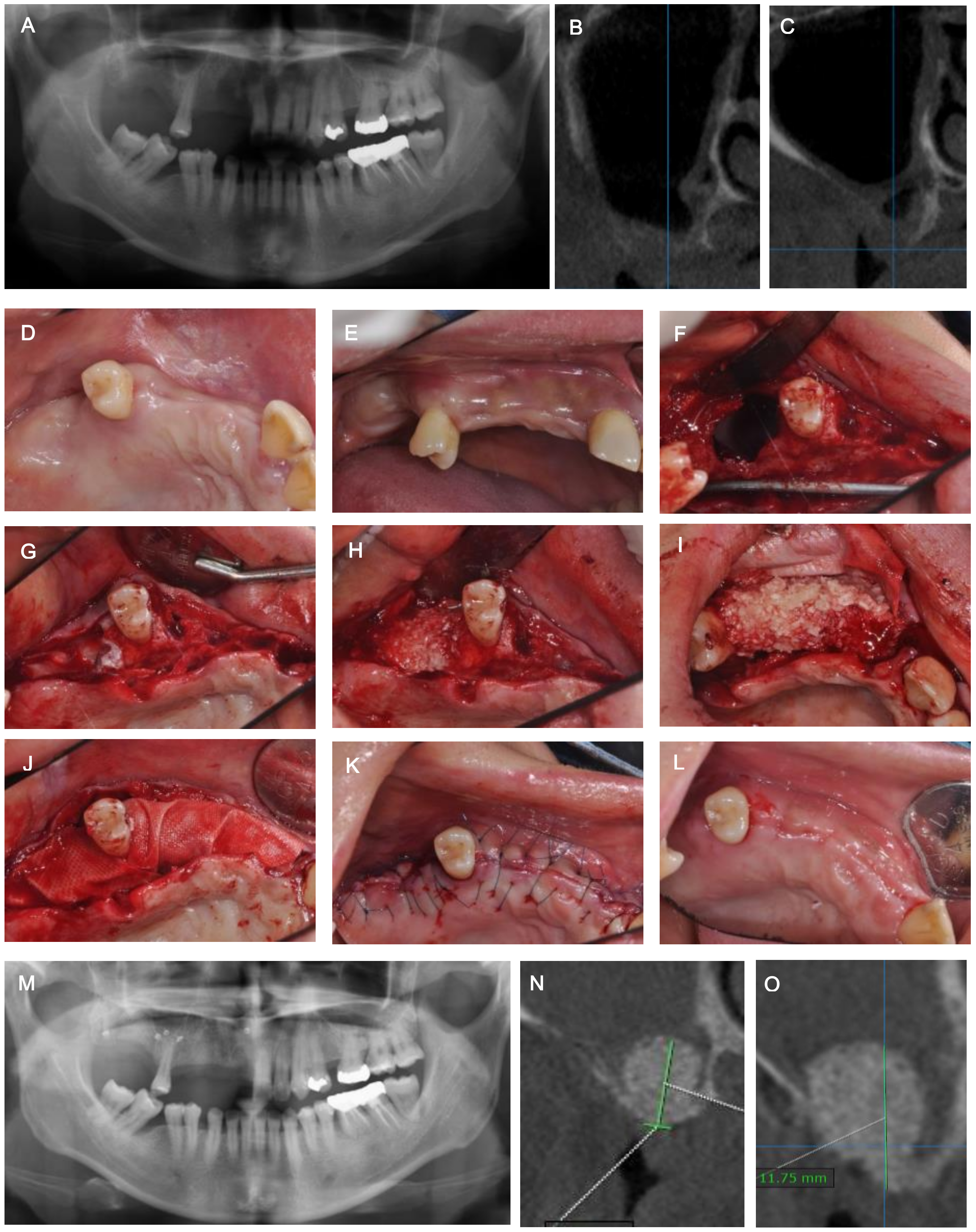 Medicina 57 00626 g001