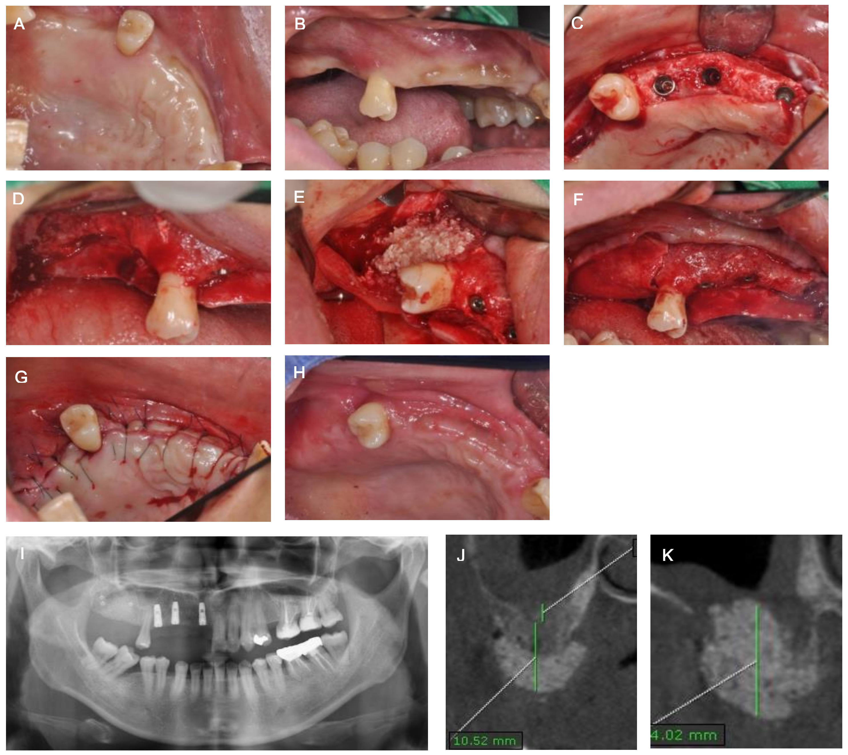 Medicina 57 00626 g002