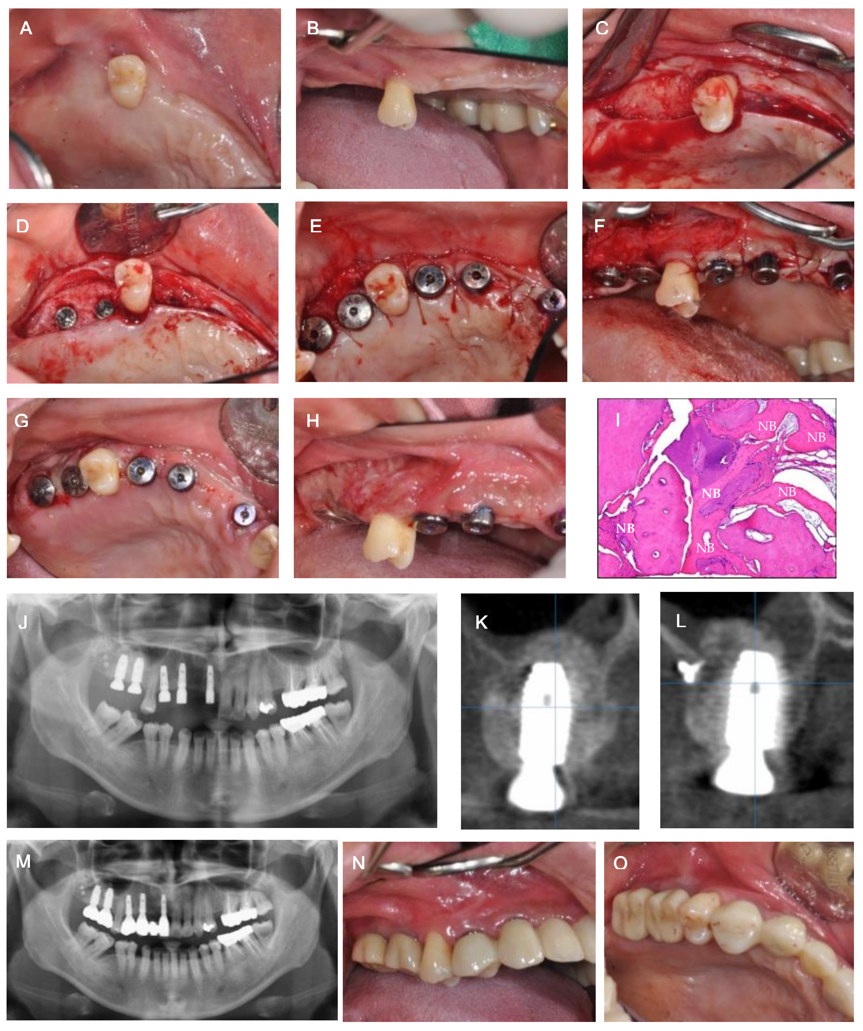 Medicina 57 00626 g003