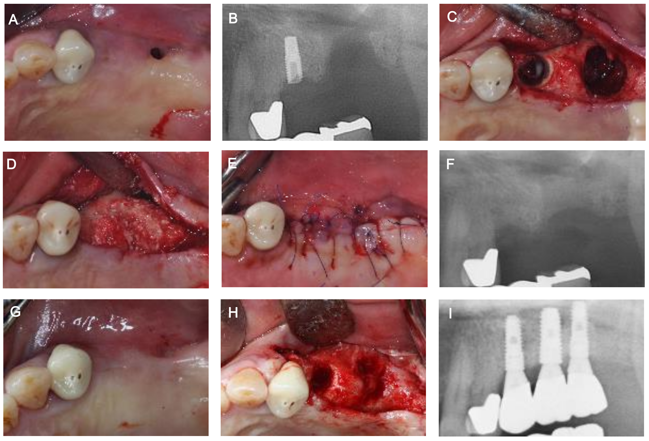 Medicina 57 00626 g004