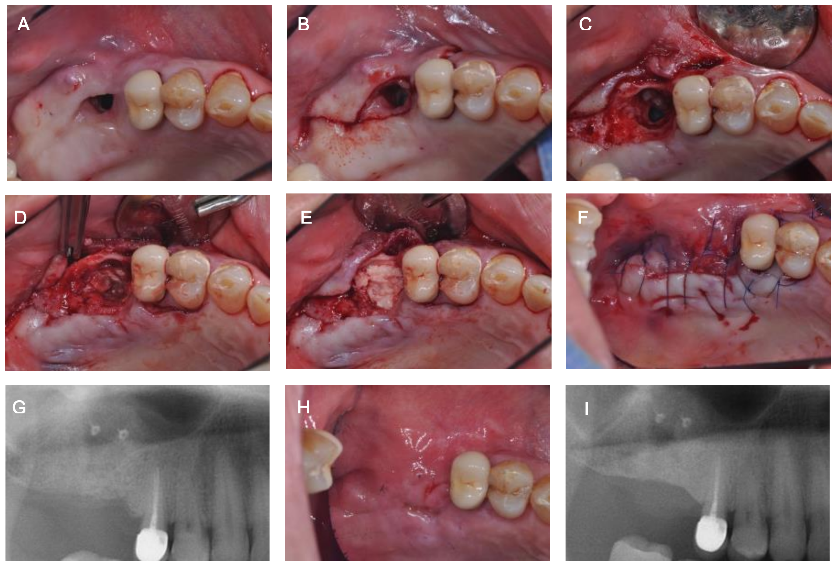 Medicina 57 00626 g005