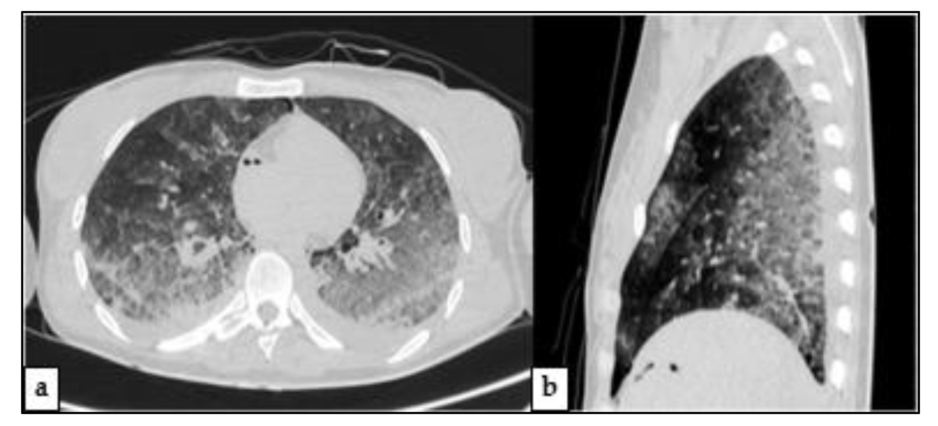 Medicina 57 00644 g002