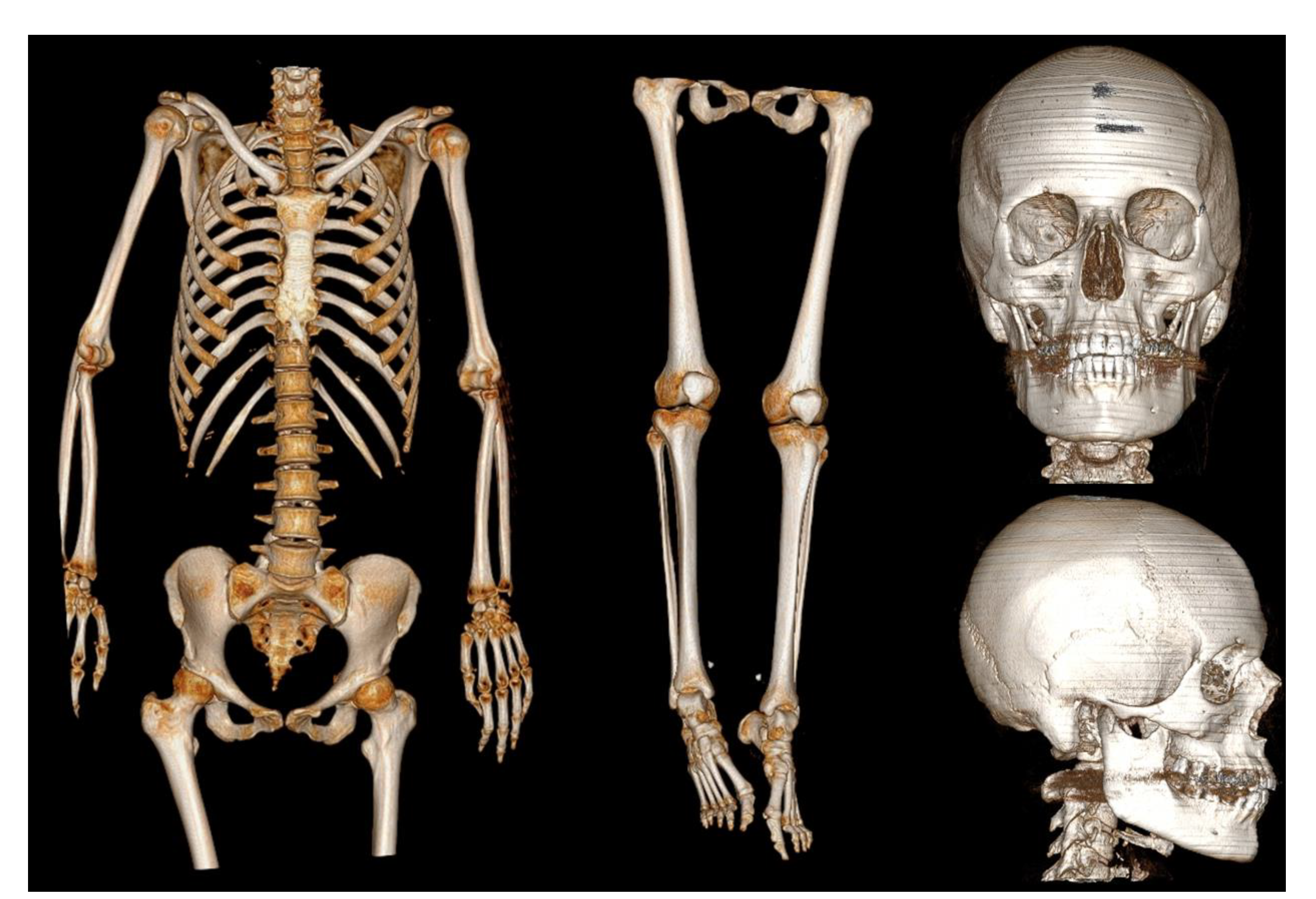 Medicina 57 00644 g003