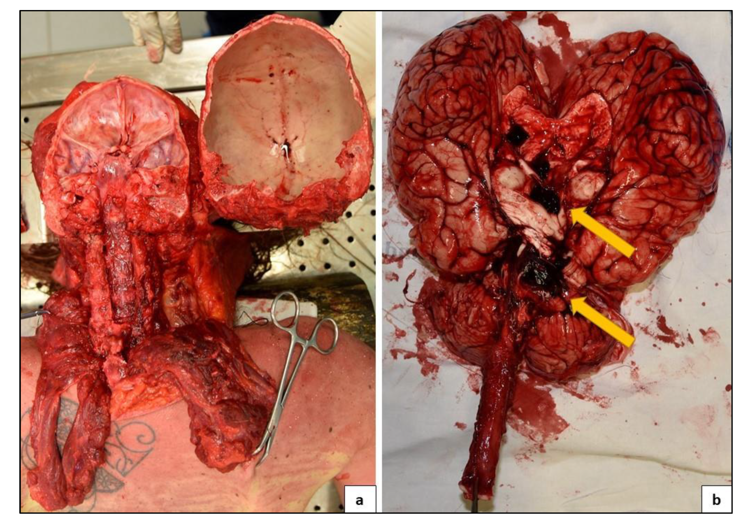 Medicina 57 00644 g004